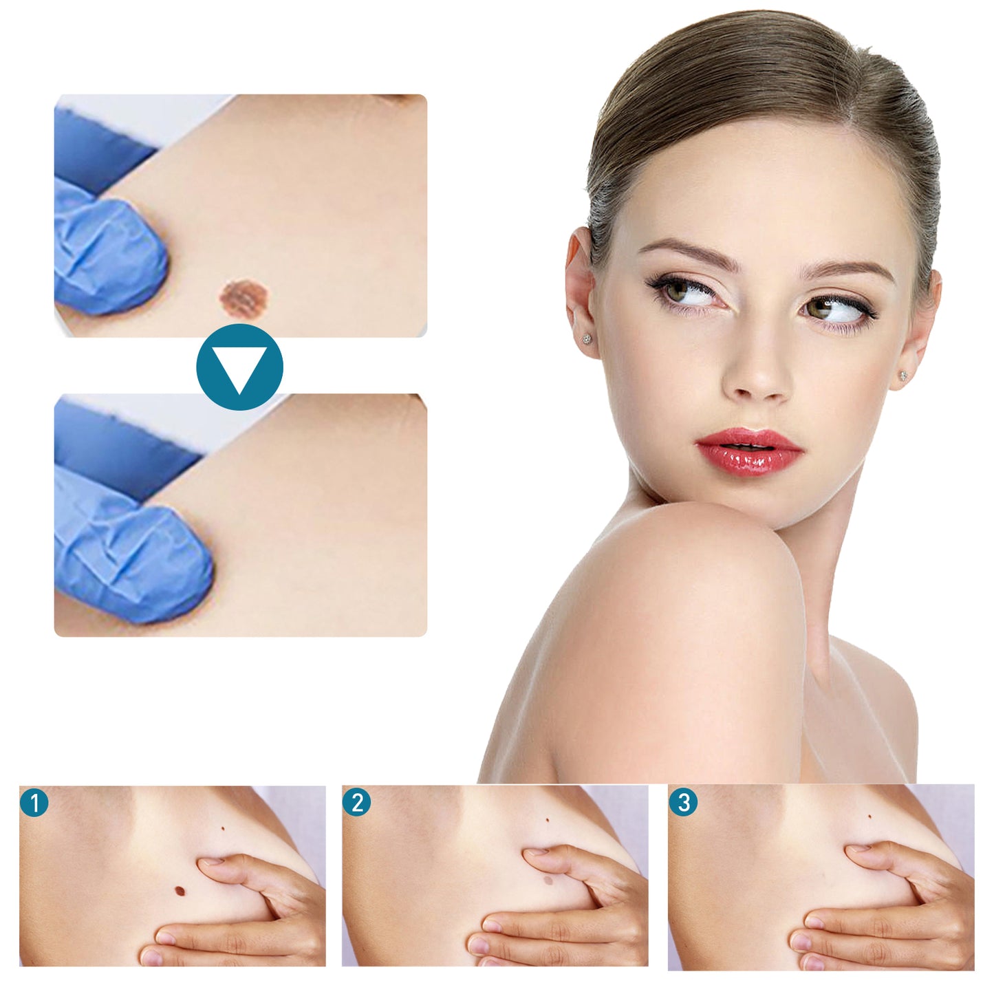 Kwart Patch, Clean And Fade Skin Moles Moles Corns Filamentary Warts Body Skin Care Flat Wart Patch Health Eprolo https://www.cyberehub.com