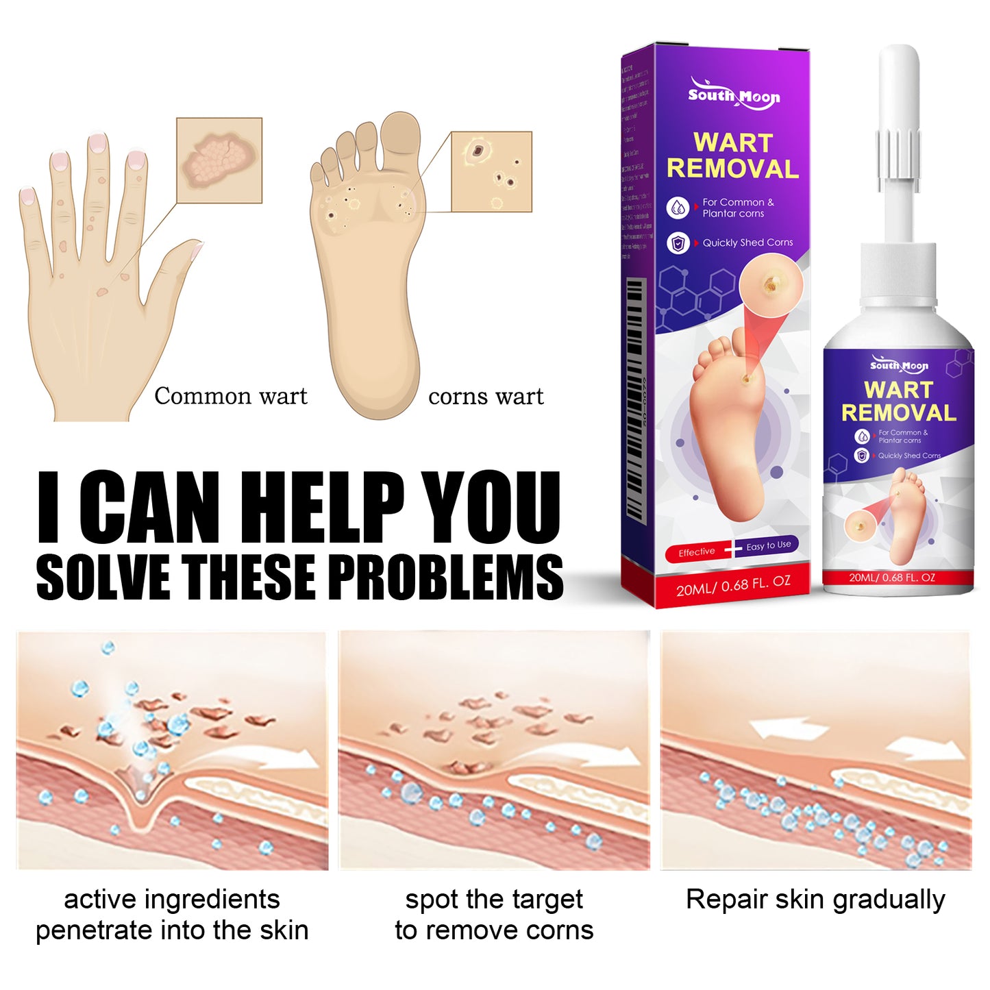 Remove Chicken Eye Lotion Extra Clear Remove Corns Skin Care Chicken Calluses Foot Pad Gram Warts Health Eprolo https://www.cyberehub.com