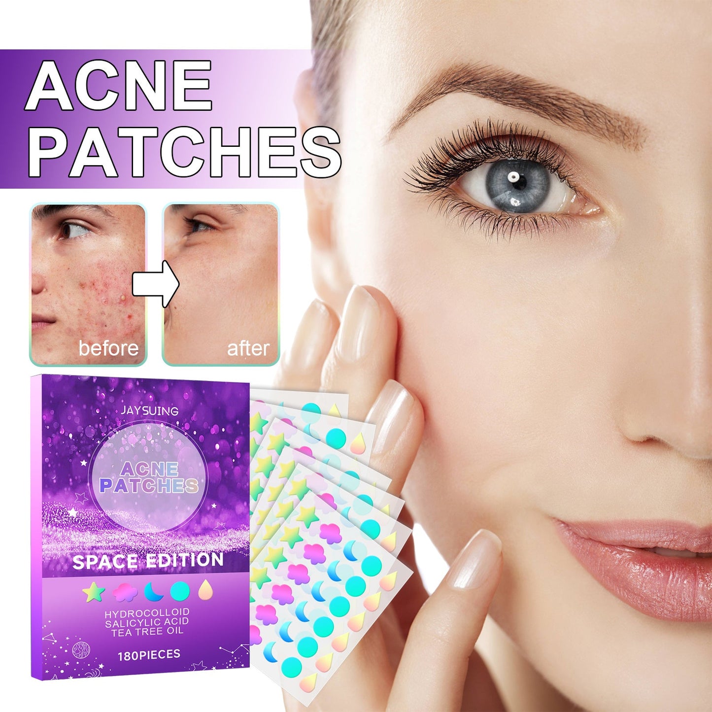 Diminish Facial Acne And Pimple Patches Health & Beauty Health & Beauty Under 10 UniversalMaax https://www.cyberehub.com