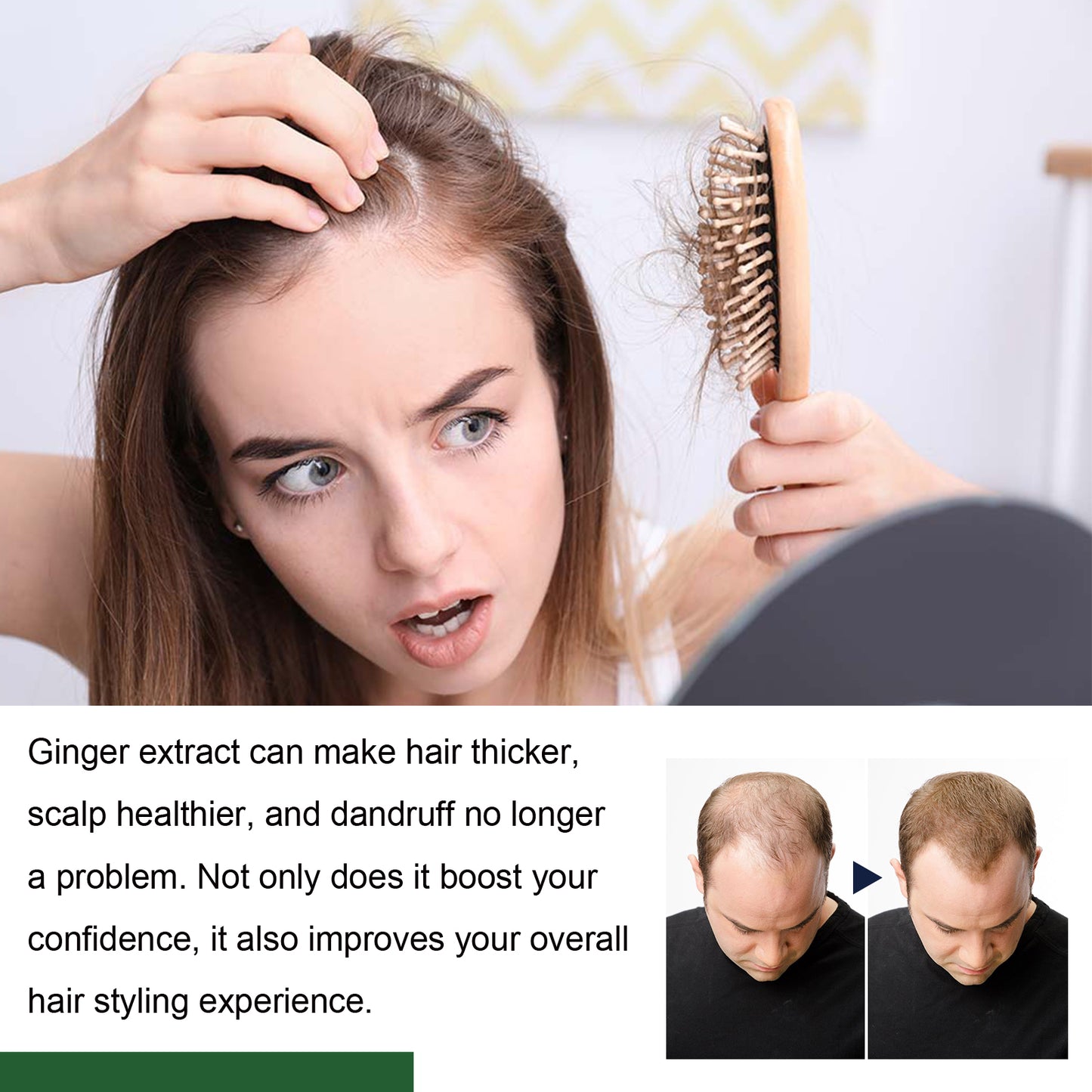 Ginger Hair Care Ball Scalp Care Nourishes Soft, Fluffy, Glossy Hair And Strengthens Hair Health Eprolo https://www.cyberehub.com