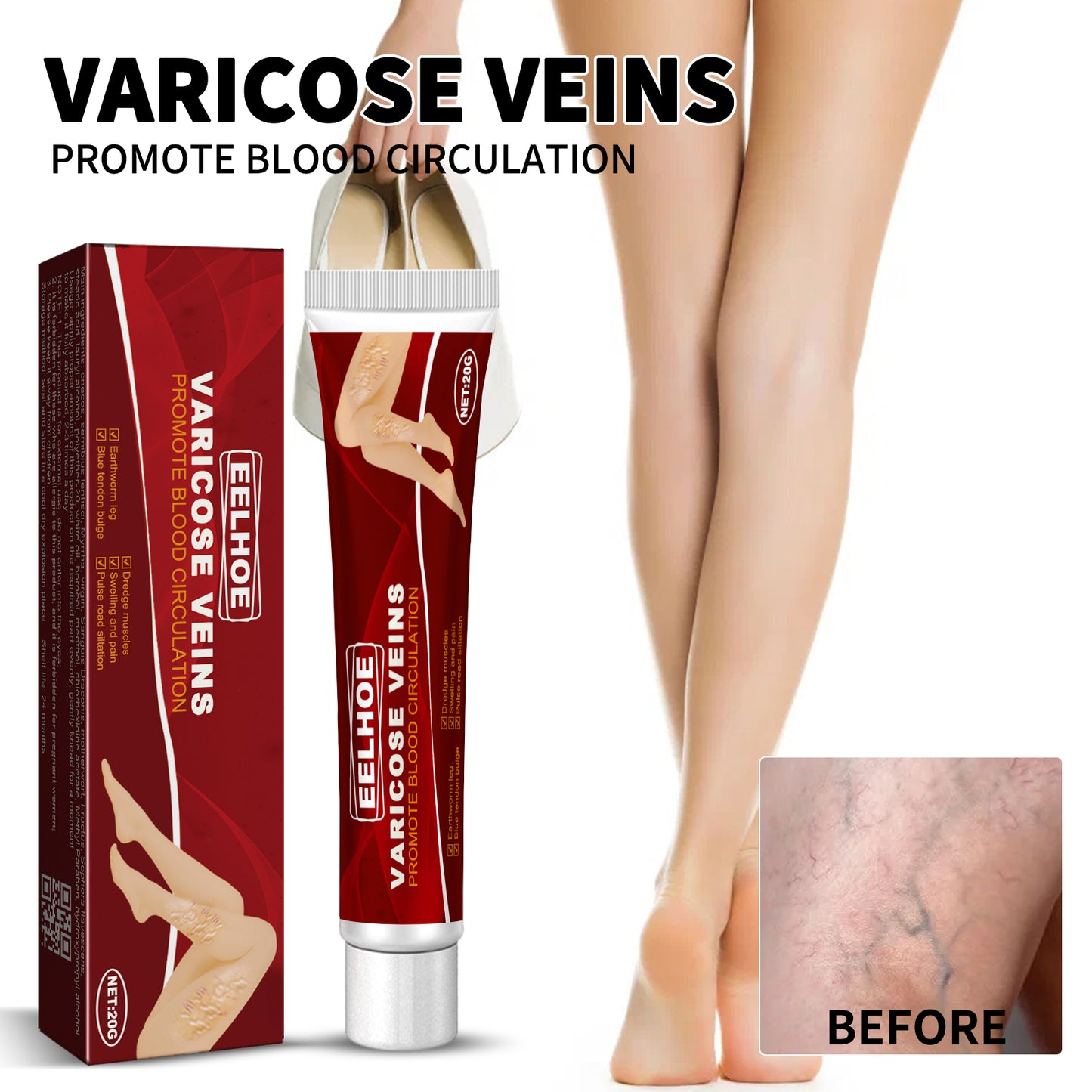 Venous Massage Varicose Cream, Relieves Bulging Leg Blood Vessels And Swollen Leg Earthworm Venous Massage Cream Health Eprolo https://www.cyberehub.com