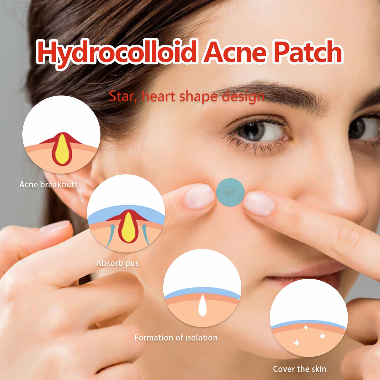 Hydrocolloid Acne Patch, Mild Non-Irritant Lightening Acne Pimples Closed Mouth Improve Acne Muscle Hydrocolloidal Acne Patch Health Eprolo https://www.cyberehub.com