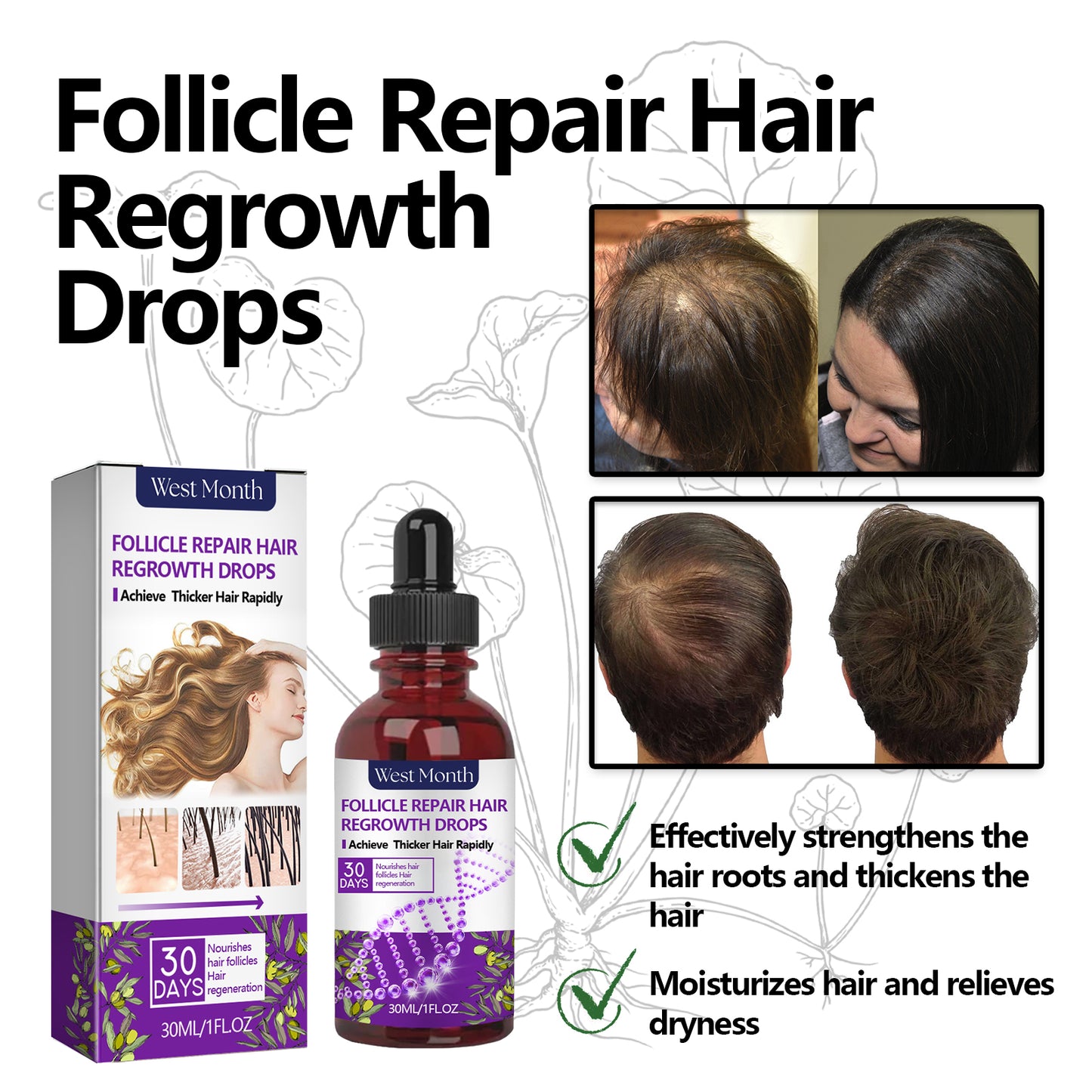 Follicle Repair Hair Regrowth Drops, Hair Protection Strong And Solid Hair Thickening Scalp Nourishing Massage Lotion Health Eprolo https://www.cyberehub.com