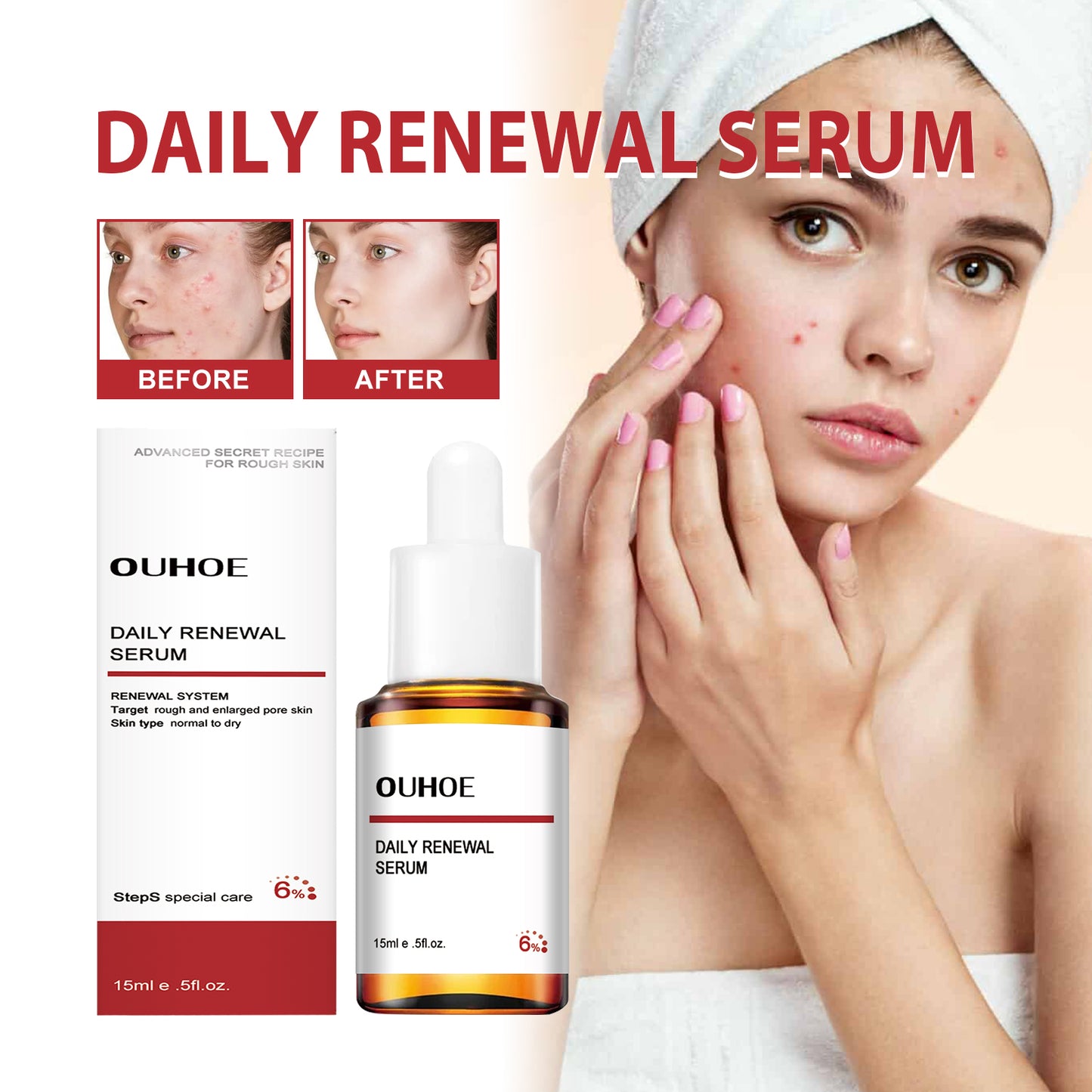 Mandelic Acid Daily Update Essence, Acne-Removing And Acne-Closing Repair Brightening Fruit Acid Essence Health Eprolo https://www.cyberehub.com