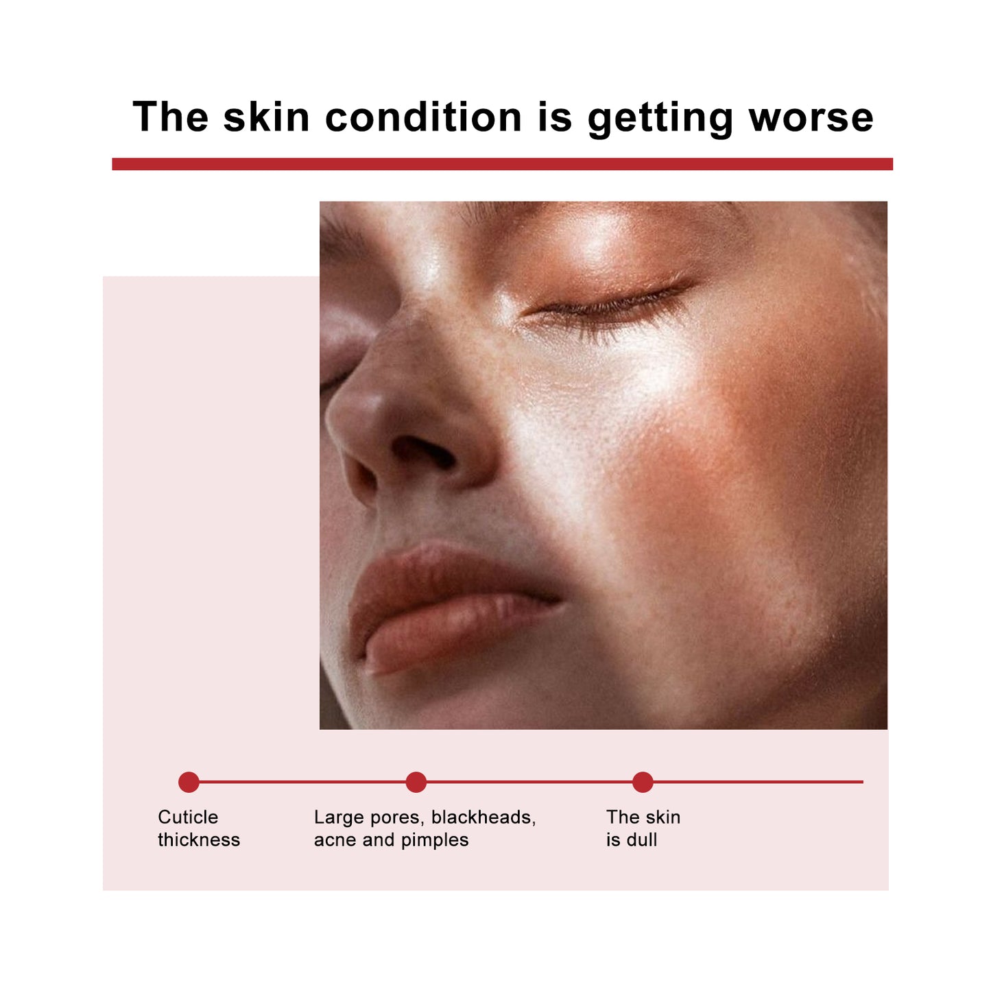 Mandelic Acid Daily Update Essence, Acne-Removing And Acne-Closing Repair Brightening Fruit Acid Essence Health Eprolo https://www.cyberehub.com