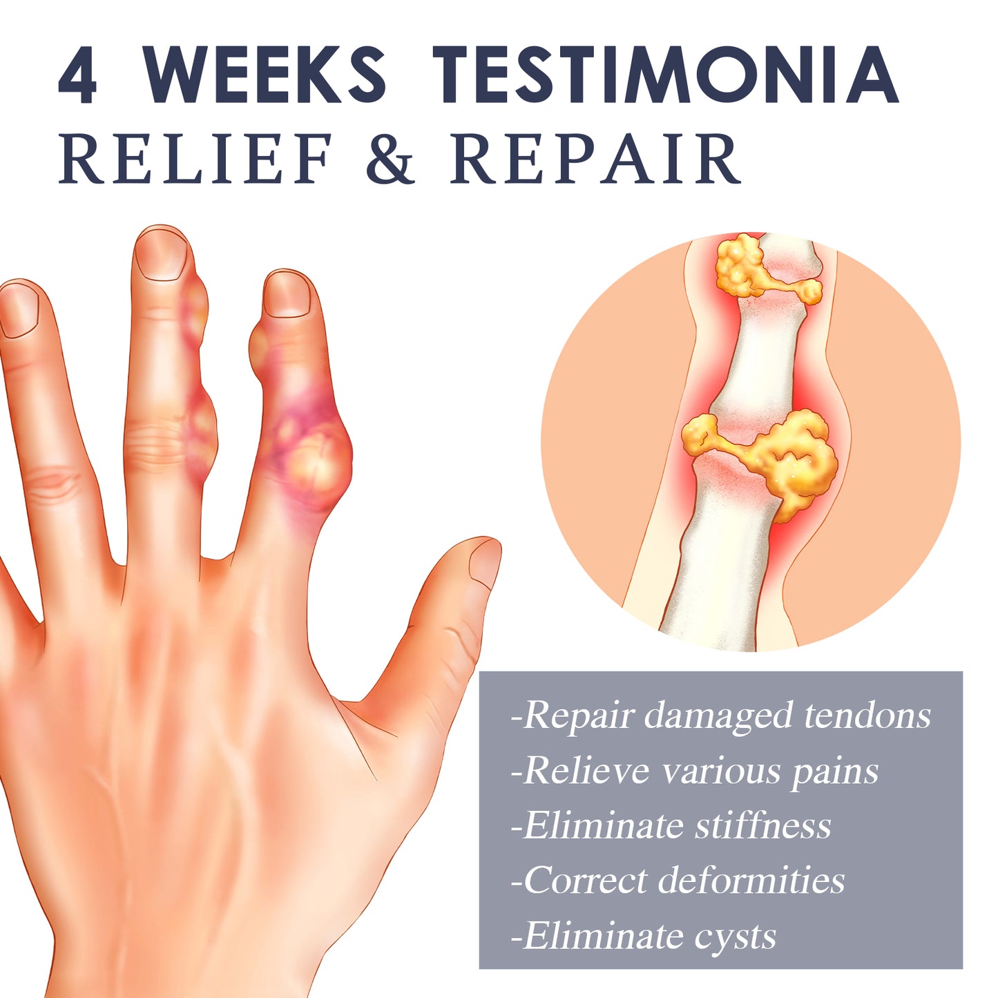 Bee Venom Joint Spray, Relieves Hands Legs Bones Knees Lumbar Vertebra Sedentary Joint Pain Body Care Spray Health Eprolo https://www.cyberehub.com