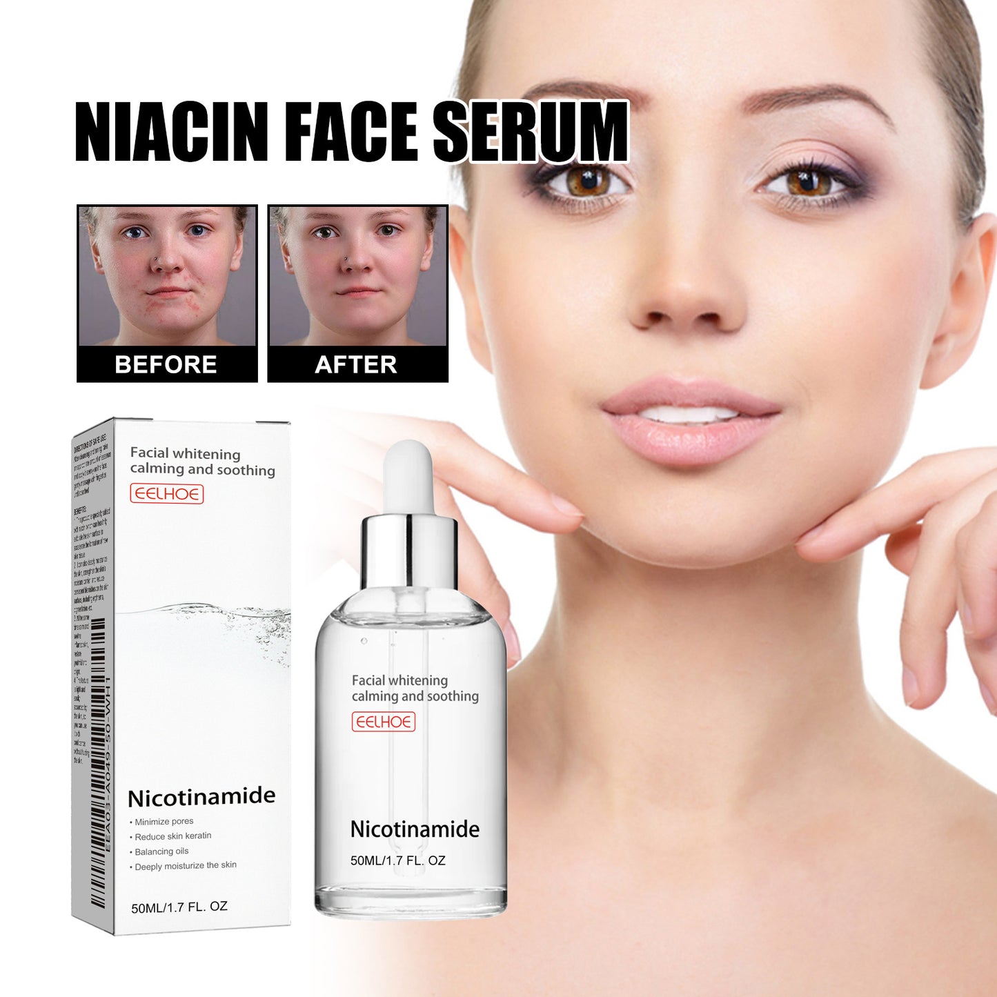 Nicotinic Acid Face Essence Lighten Acne Marks, Moisturize Pores, Shrink And Whiten Skin Beauty Essence Health Eprolo https://www.cyberehub.com