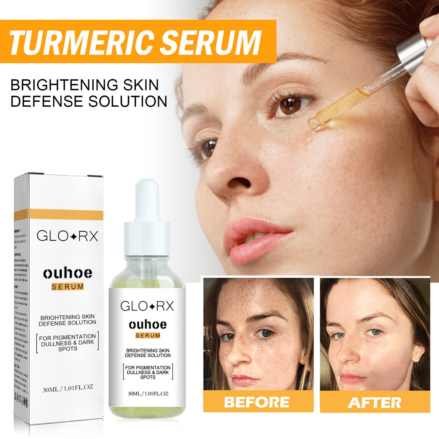 Turmeric Whitening Spot Serum, Lighten Freckle Spots Brightening Skin Hydrating Serum default title Health Eprolo https://www.cyberehub.com