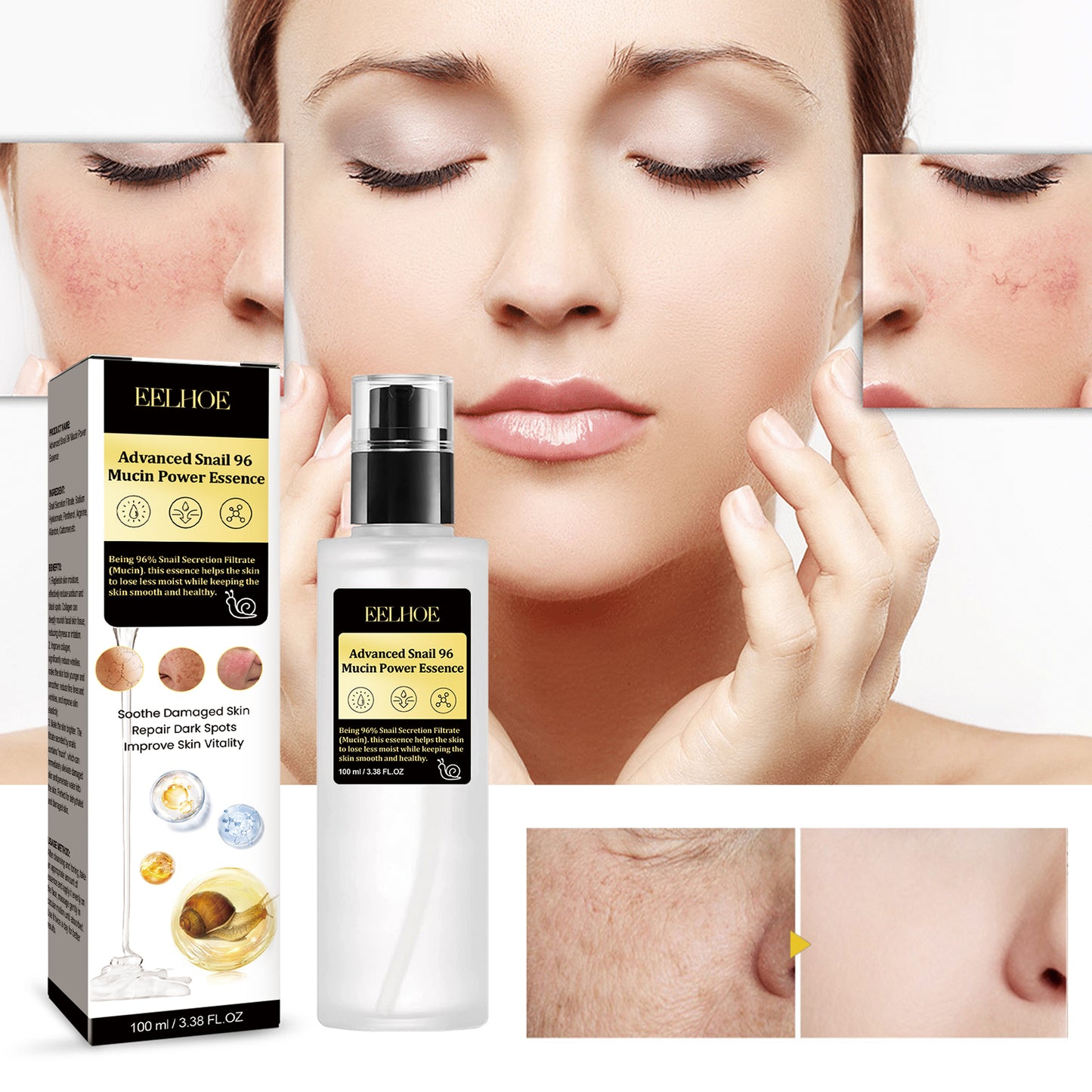 Snail 96 Collagen Essence Lighten Fine Lines, Tender Skin and Moisturize acne muscles Health Eprolo https://www.cyberehub.com