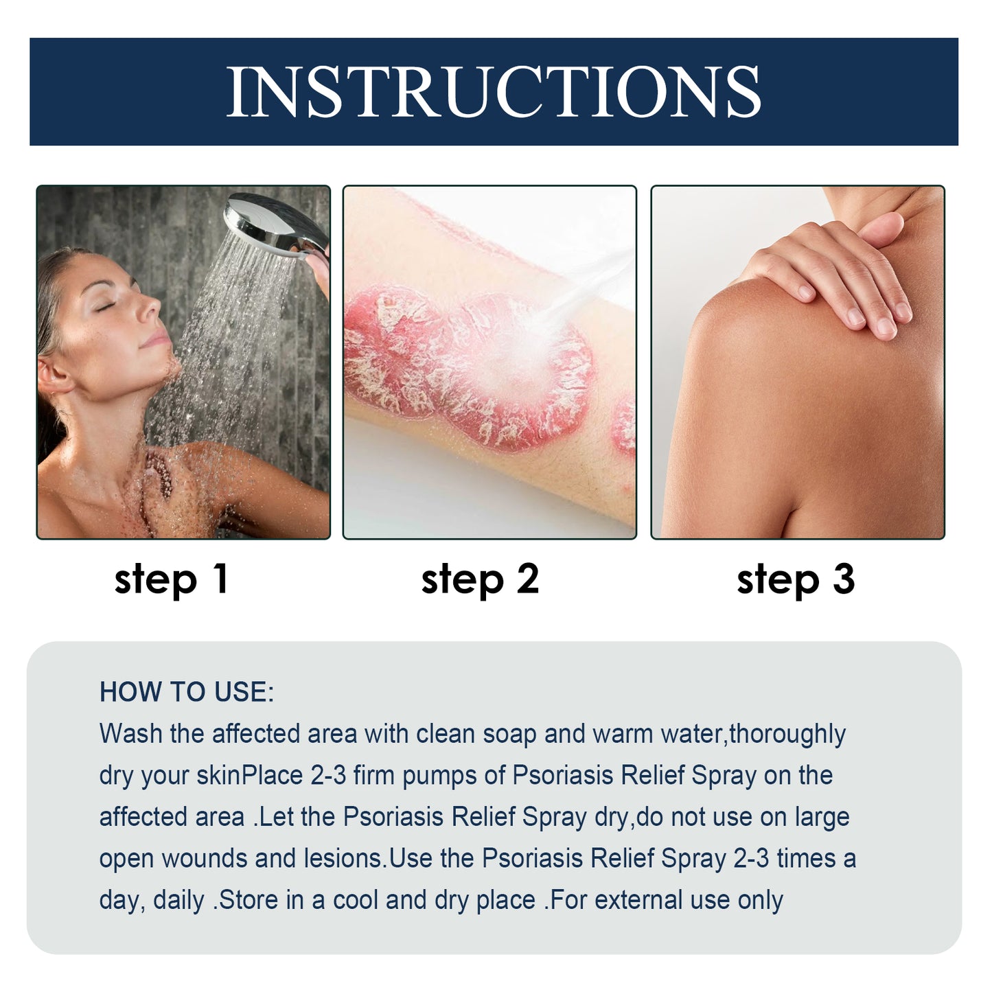 Psoriasis Relief Spray, Relieve Skin, Hands And Feet Redness Peeling Itch Repair External Care Health Eprolo https://www.cyberehub.com