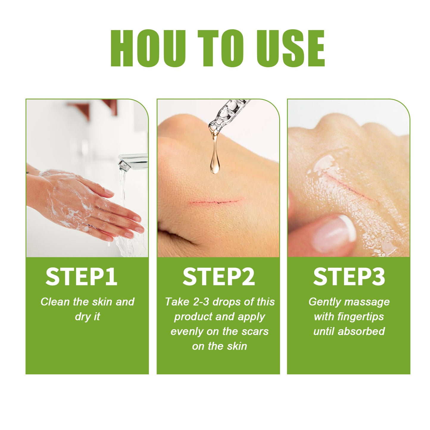 Scar Repair Serum Reduces Scar Acne Mark Pregnancy Surgery Scar Repair Smooth Skin Care Health Eprolo https://www.cyberehub.com