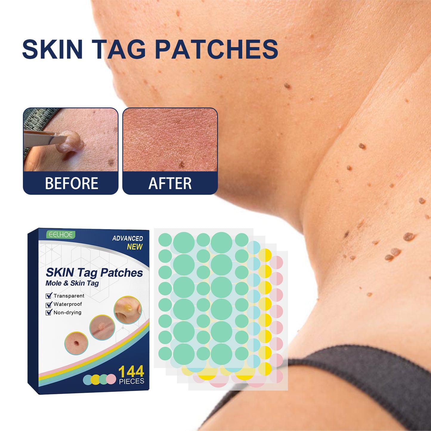 Kwart Patch, Clean And Fade Skin Moles Moles Corns Filamentary Warts Body Skin Care Flat Wart Patch Health Eprolo https://www.cyberehub.com