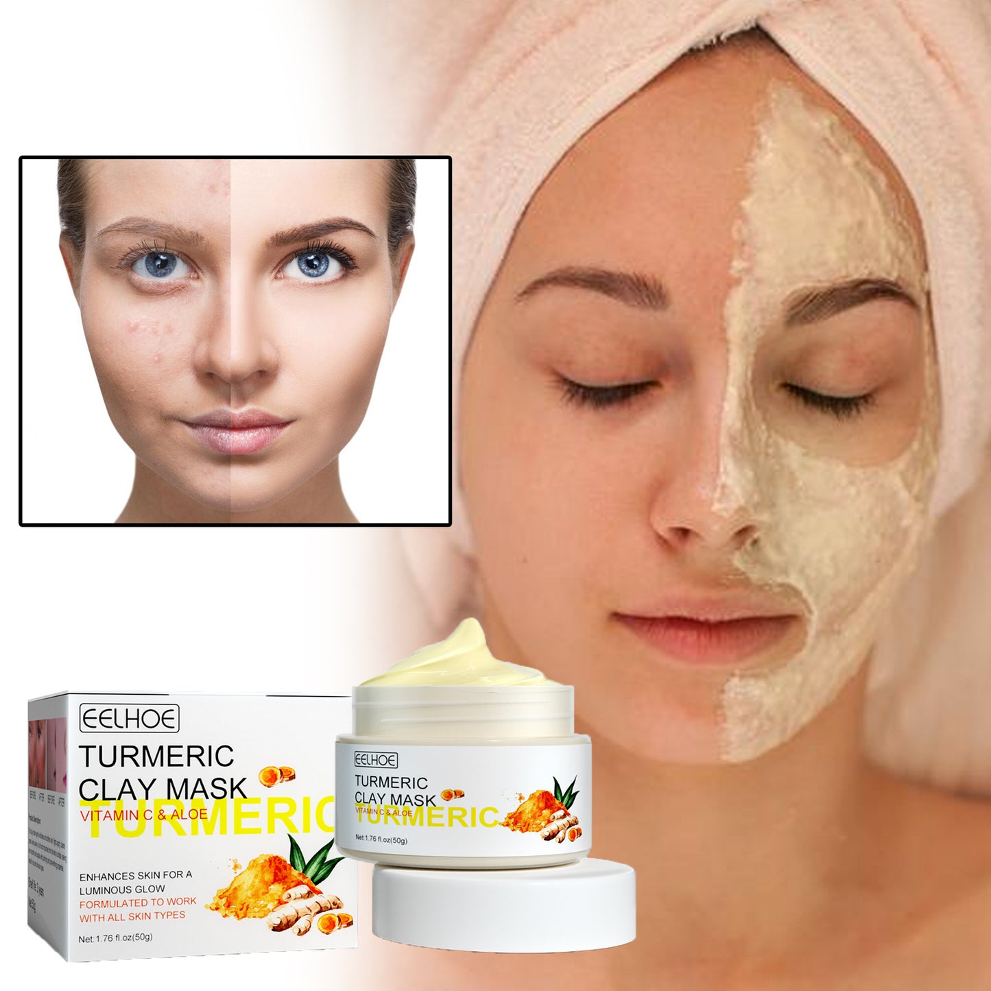Turmeric Clay Mask, Facial Acne-Clearing Q10 Deeply Cleanses, Hydrates, Brightens And Shrinks Pores Health Eprolo https://www.cyberehub.com