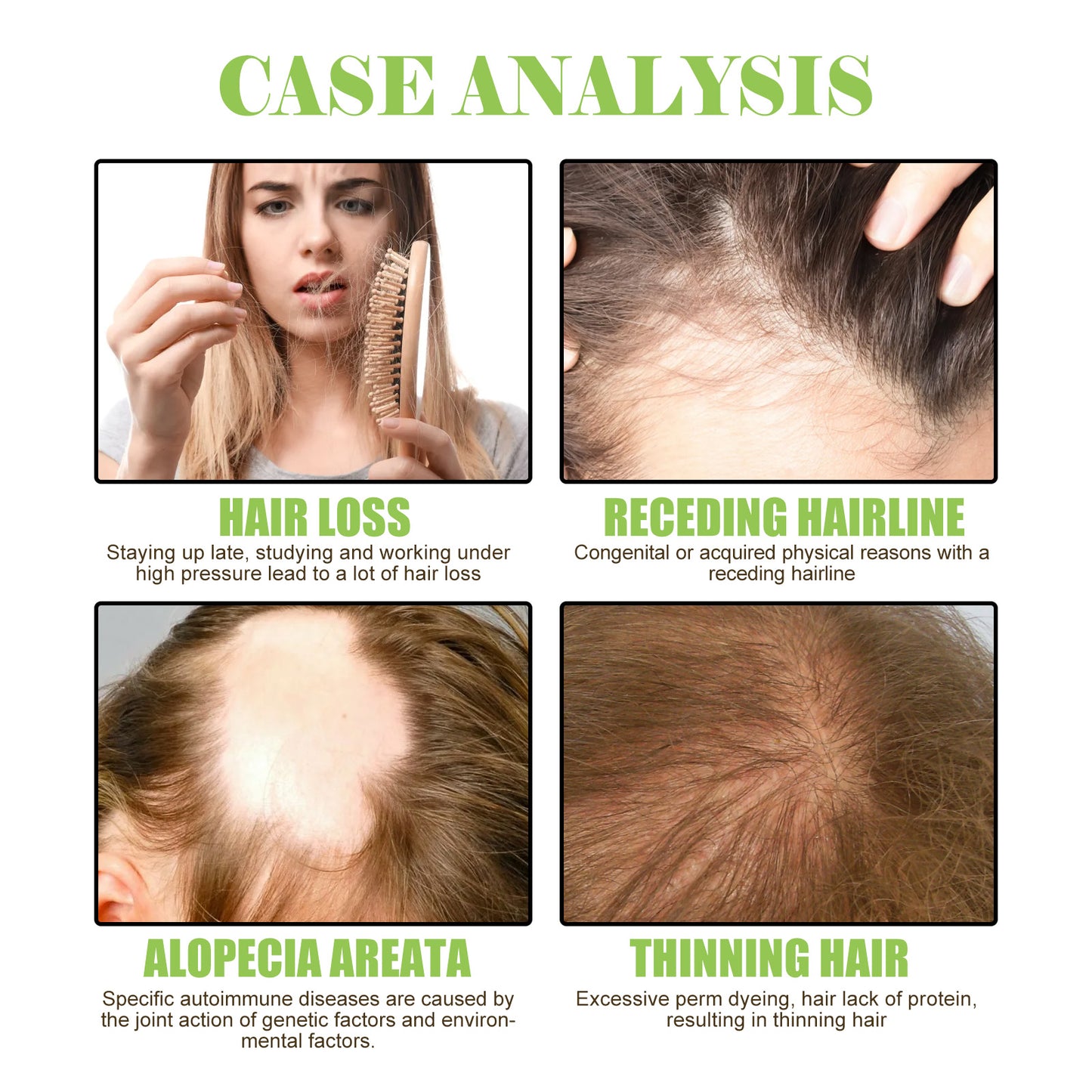 Ginger Care Shampoo Scalp Cleansing, Anti-Break Nourishing Root Strengthening Shampoo Health Eprolo https://www.cyberehub.com
