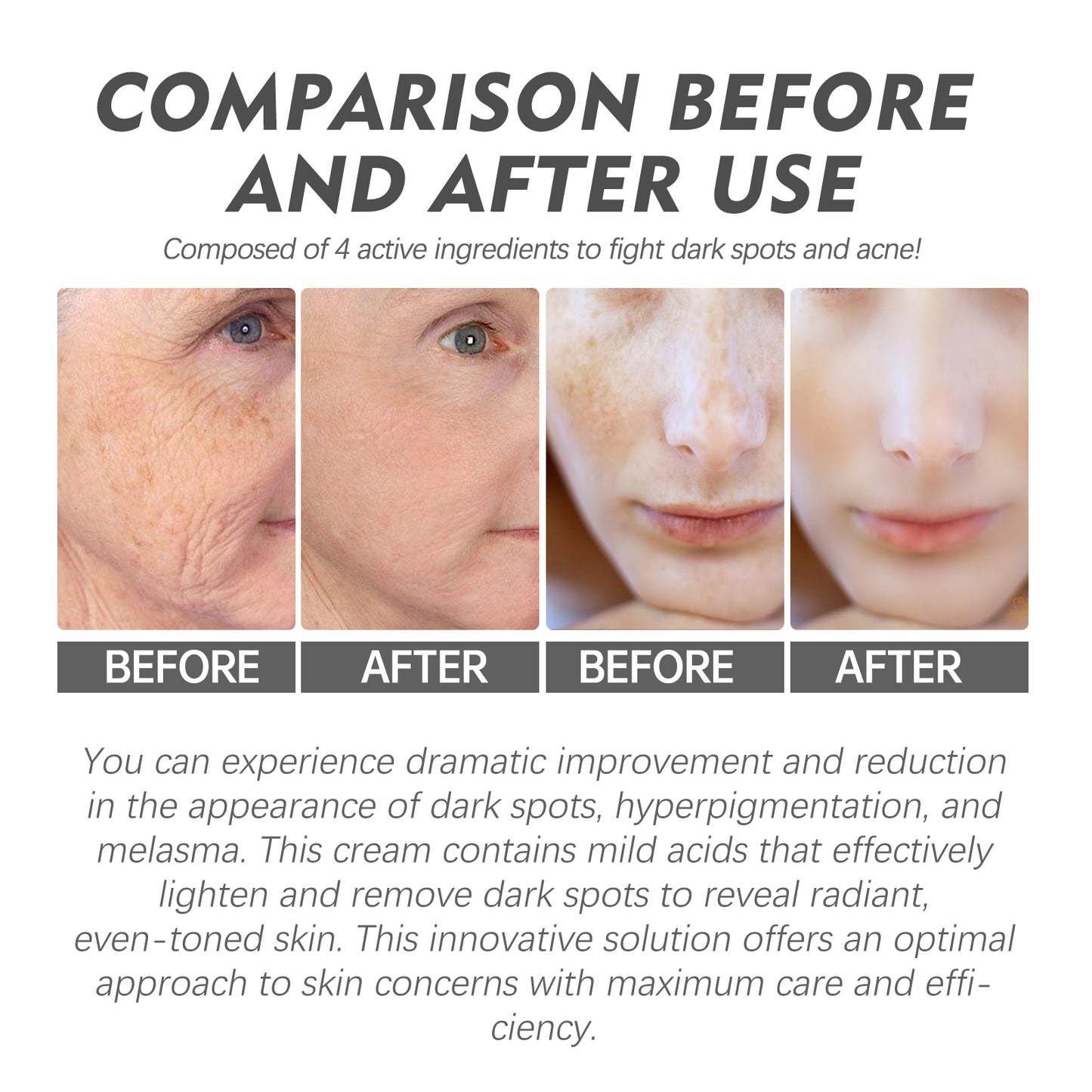 Speckle Corrector Cream, Lighten Spots And Wrinkles Repair Dull Skin Hydrating Brightening Cream Health Eprolo https://www.cyberehub.com