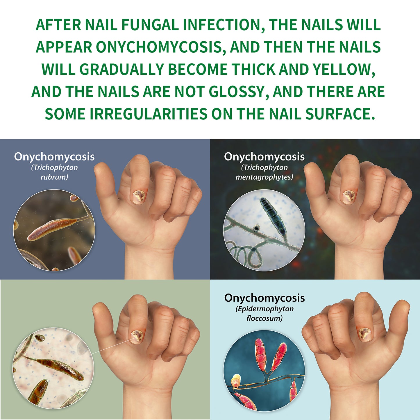 Jaysuing Ginger Nail Care Solution, Repair Hand, Foot And Nail Care Soft Nail Shine Moisturizer Gray Nails Health Eprolo https://www.cyberehub.com