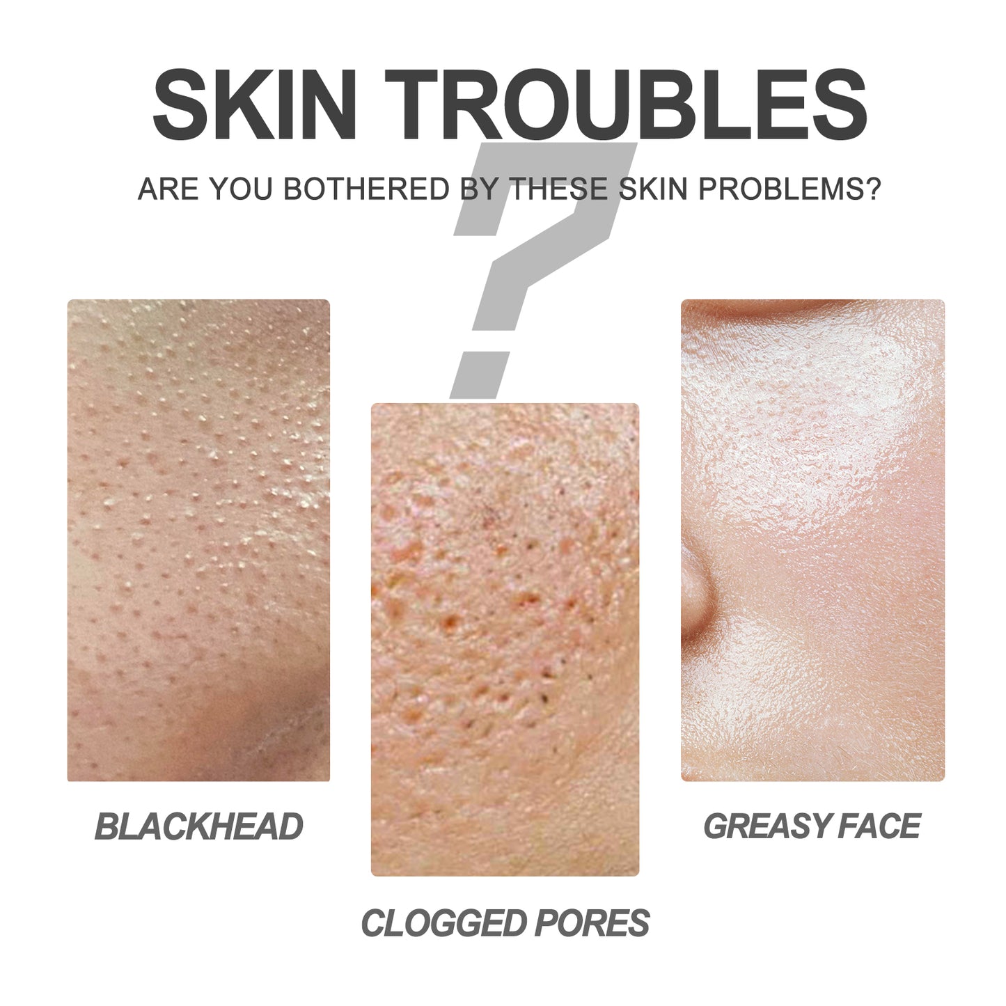 Blackhead Cleansing Cream Skin Oil Blackheads Acne Exfoliating Cleansing Repair Pore Tearing Nose Patch Health Eprolo https://www.cyberehub.com