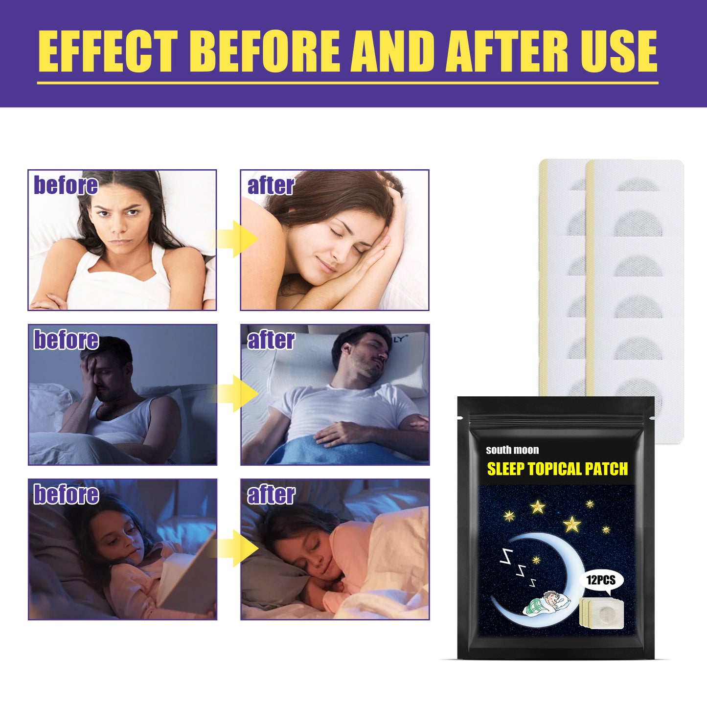 Sleep Patch Home Gentle Care To Improve Sleep Quality Daily Body Care Patch Health Eprolo https://www.cyberehub.com