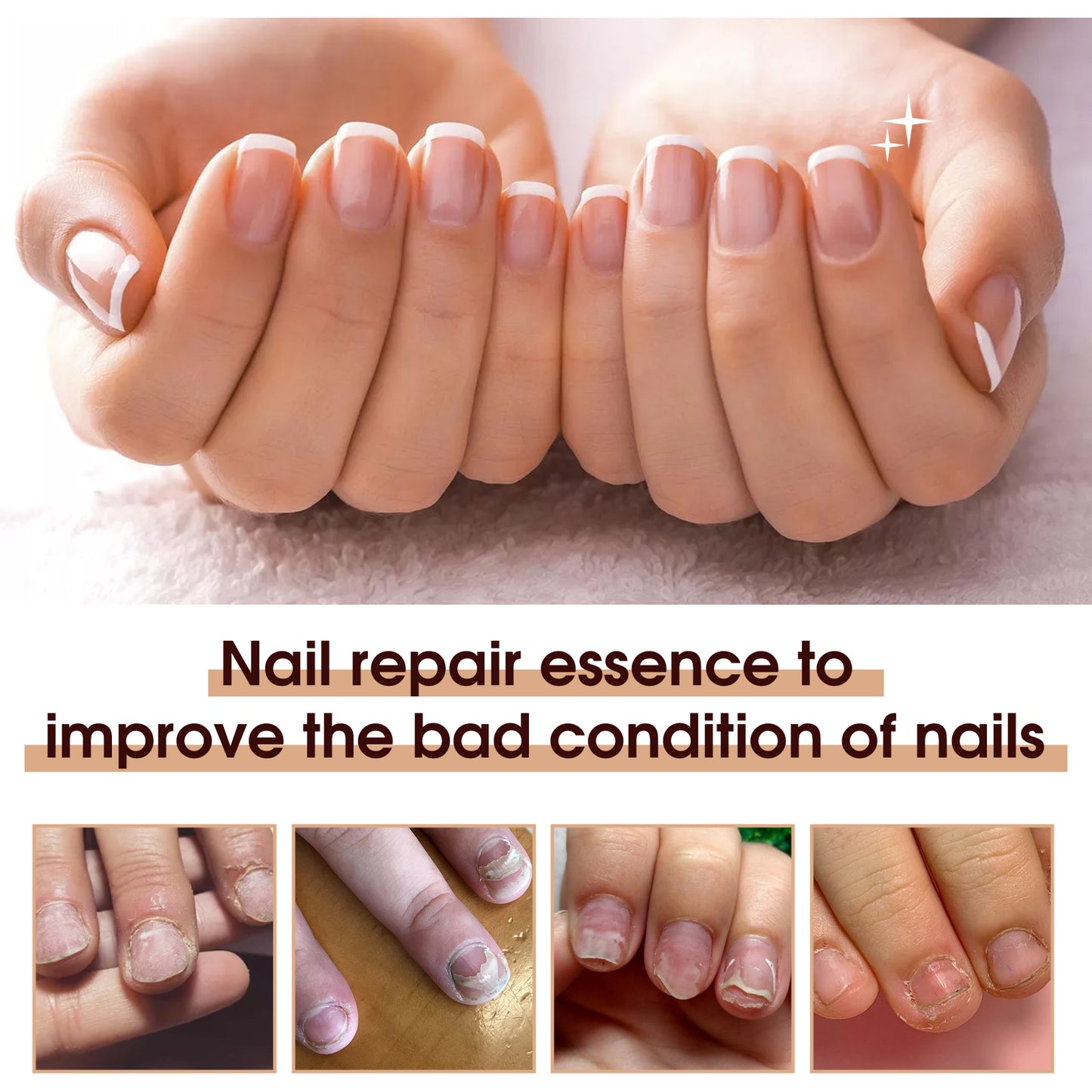 Therapy Vitamin E Serum, Hand And Foot Nail Repair Bright Nail Grey Nail Soft Nail Embedded Nail Care Essence Health Eprolo https://www.cyberehub.com