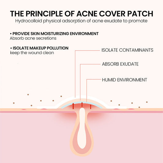 Spotted Acne Scars Cover Acne Patches Health & Beauty Health & Beauty Under 10 UniversalMaax https://www.cyberehub.com