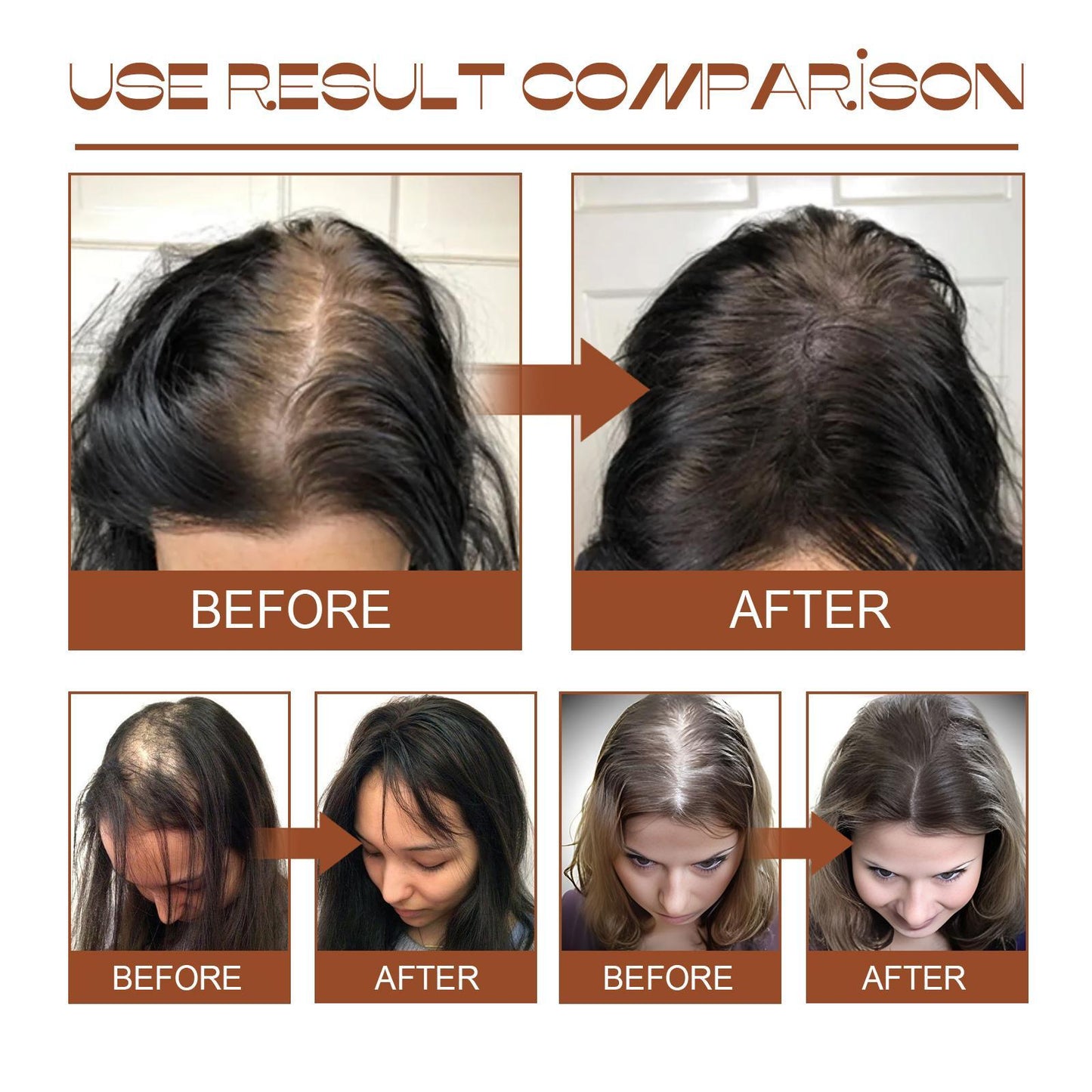 Batana Oil From Honduras - Get Fuller, Thicker, Healthier Hair - Great Gifts For Women Men Conditioner Haircare Silky - Hair Nutrition Health Beauty CJ USa USPS Muqe https://www.cyberehub.com