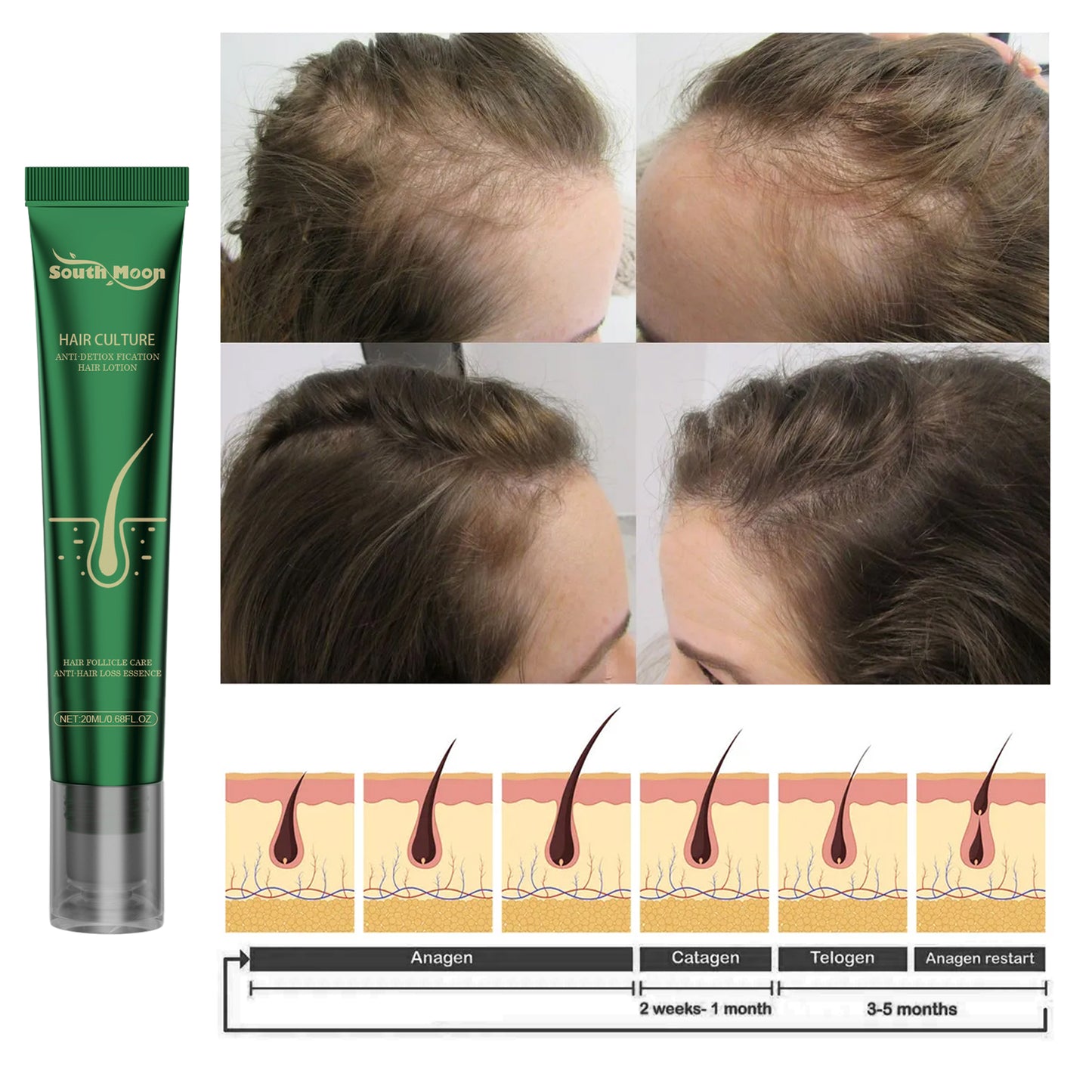 Scalp Essence Ginger Gently Moisturizes And Moisturizes Dry And Dry Hair Health Eprolo https://www.cyberehub.com