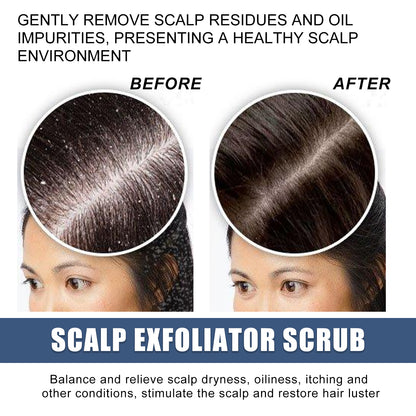 Scalp Exfoliating Scrub Moisturizes Dry Hair And Scalp Cleansing Treatment Refreshing Scrub Health Eprolo https://www.cyberehub.com