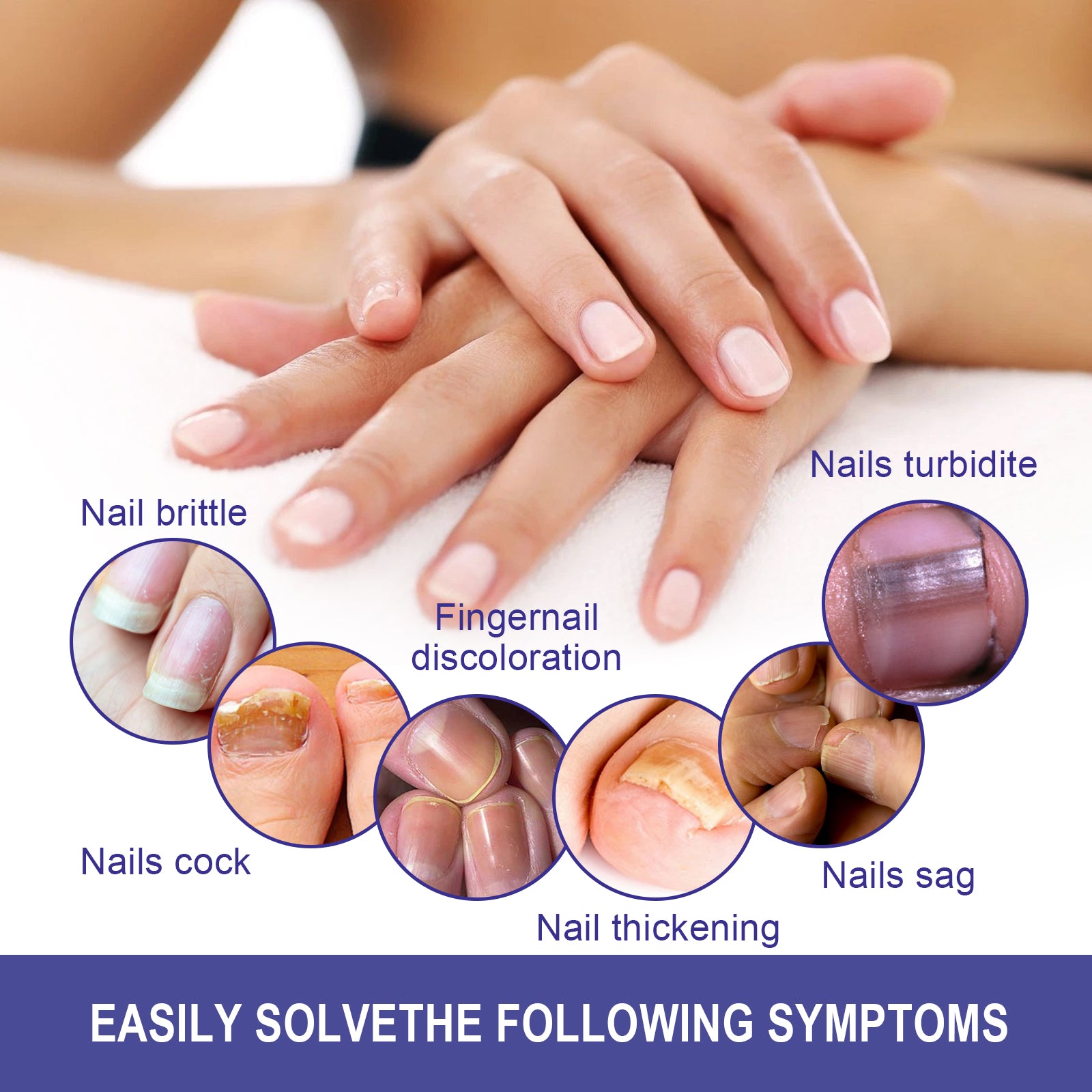 Nail Repair Lotion, Repair Thickening Nail Inlay Gray Nail Shine Soft Nail Care Solution Health Eprolo https://www.cyberehub.com