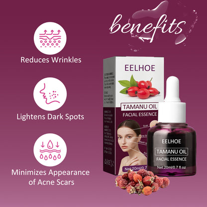 Tamanu Facial Oil, Relieves Acne Marks Fine Lines Moisturizes and Firms Skin Essential Oil Health Eprolo https://www.cyberehub.com