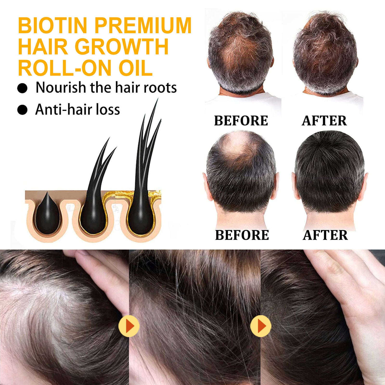 Biotin Hair Care Ball Gentle Ingredients Nourish And Moisturize Hair, Smooth And Glossy Hair Care Ball Health & Beauty Health Eprolo https://www.cyberehub.com