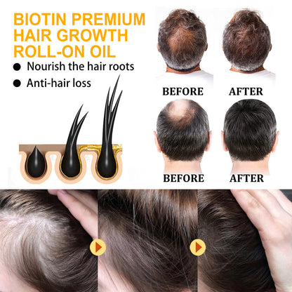 Biotin Hair Care Ball Gentle Ingredients Nourish And Moisturize Hair, Smooth And Glossy Hair Care Ball Health & Beauty Health Eprolo https://www.cyberehub.com