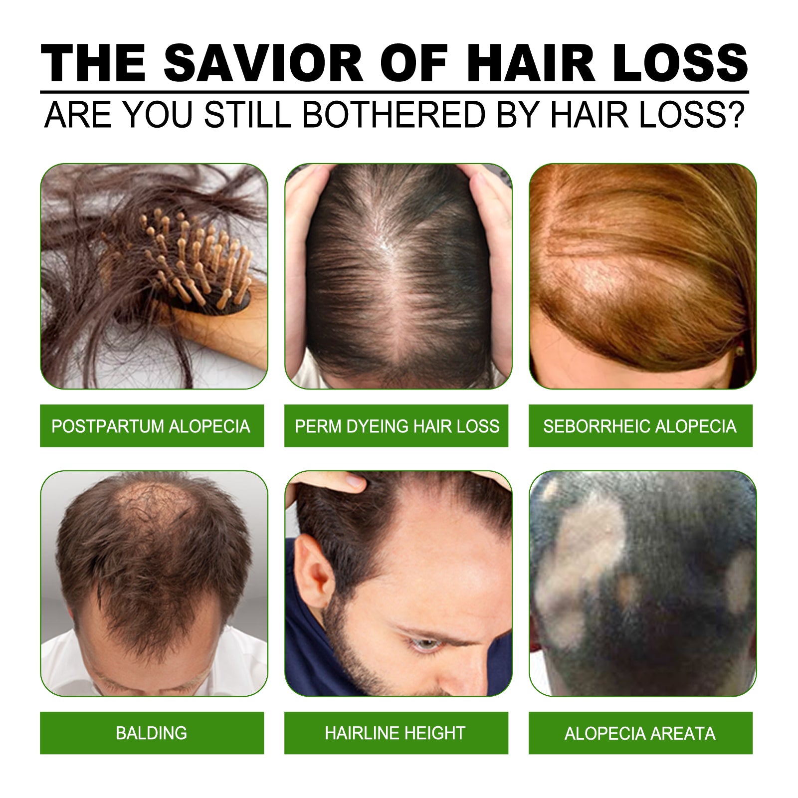 Hair Care Solution Gently Nourishes And Massages Scalp, Moisturizes And Softens Hair Care Spray Health Eprolo https://www.cyberehub.com