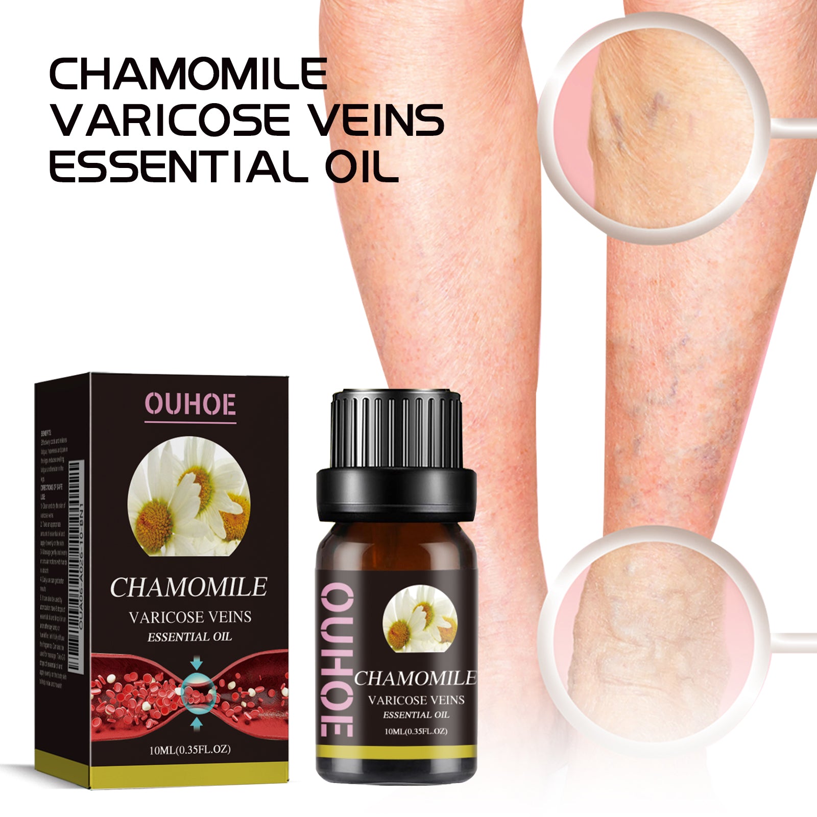 Chamomile Leg Essential Oil Protects Leg Skin And Relieves Leg Discomfort With Daily Massage Essential Oil Health Eprolo https://www.cyberehub.com