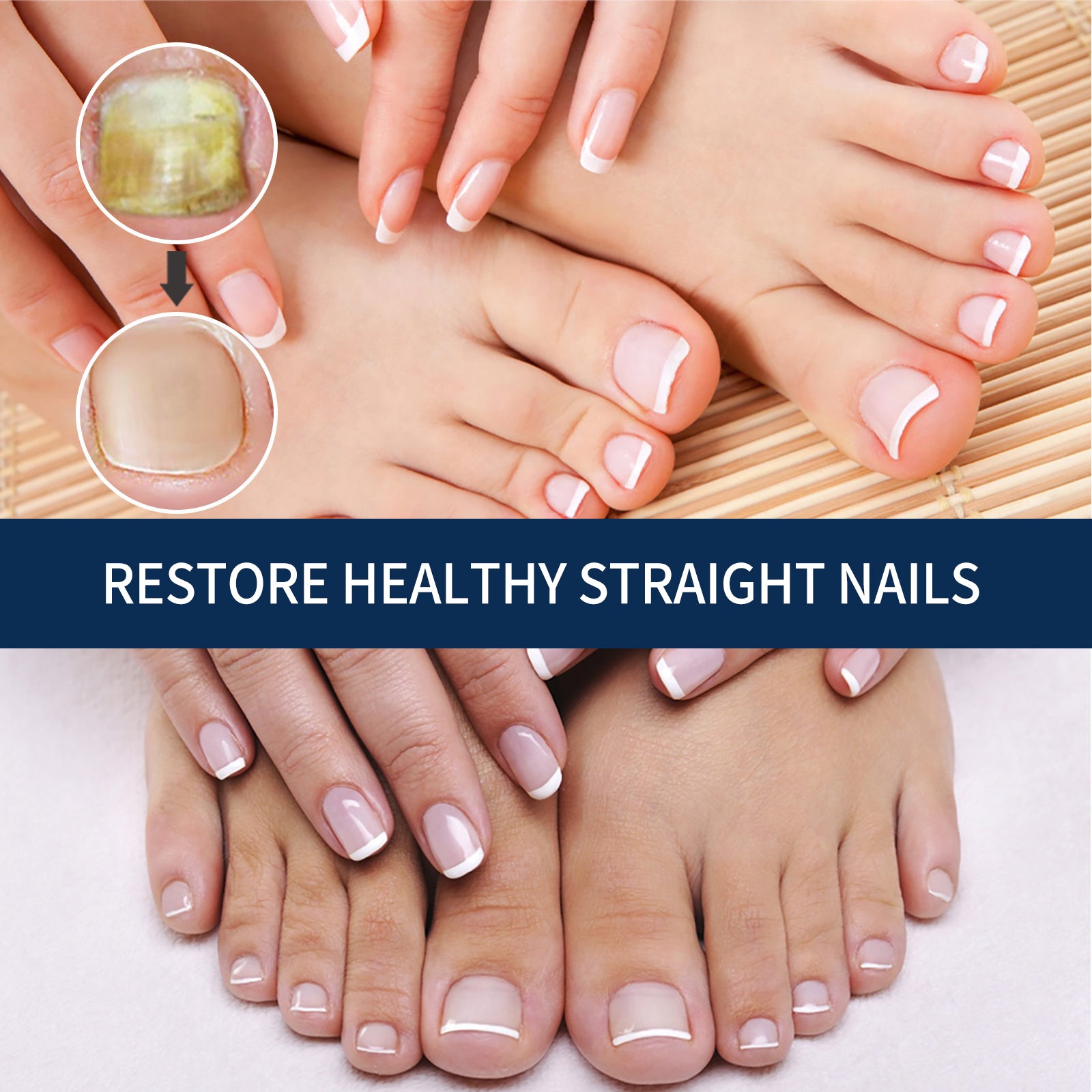 Nail Repair Relieve Essence Pen, Moisturizing Repair Hand And Foot Inlay Nail Thickening Grey Nail Correction Pen Health Eprolo https://www.cyberehub.com