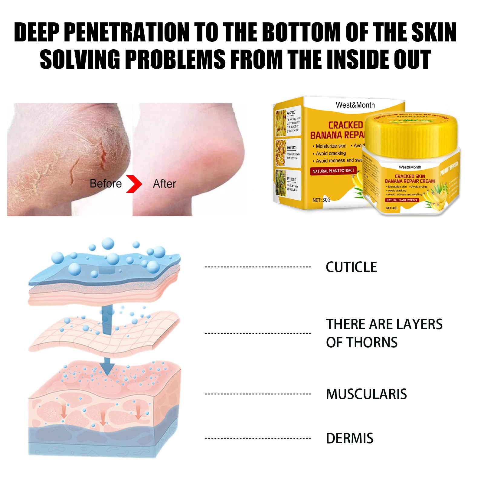 Cracked Skin Banana Repair Cream, Nourishing And Moisturizing Foot Repair Cream To Soften Exfoliation And Remove Dead Skin Calluses Health Eprolo https://www.cyberehub.com