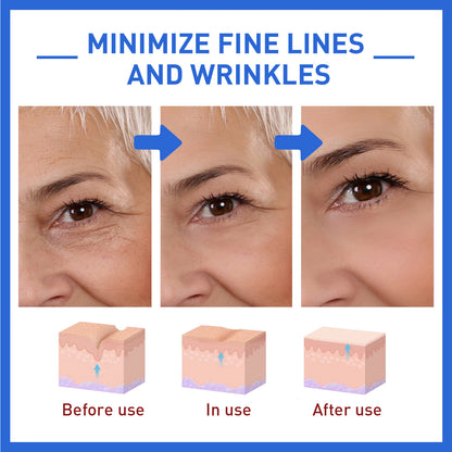 Collagen Face Essence Gently Nourishes Skin Hydrating And Moisturizing Face Care Essence Health Eprolo https://www.cyberehub.com