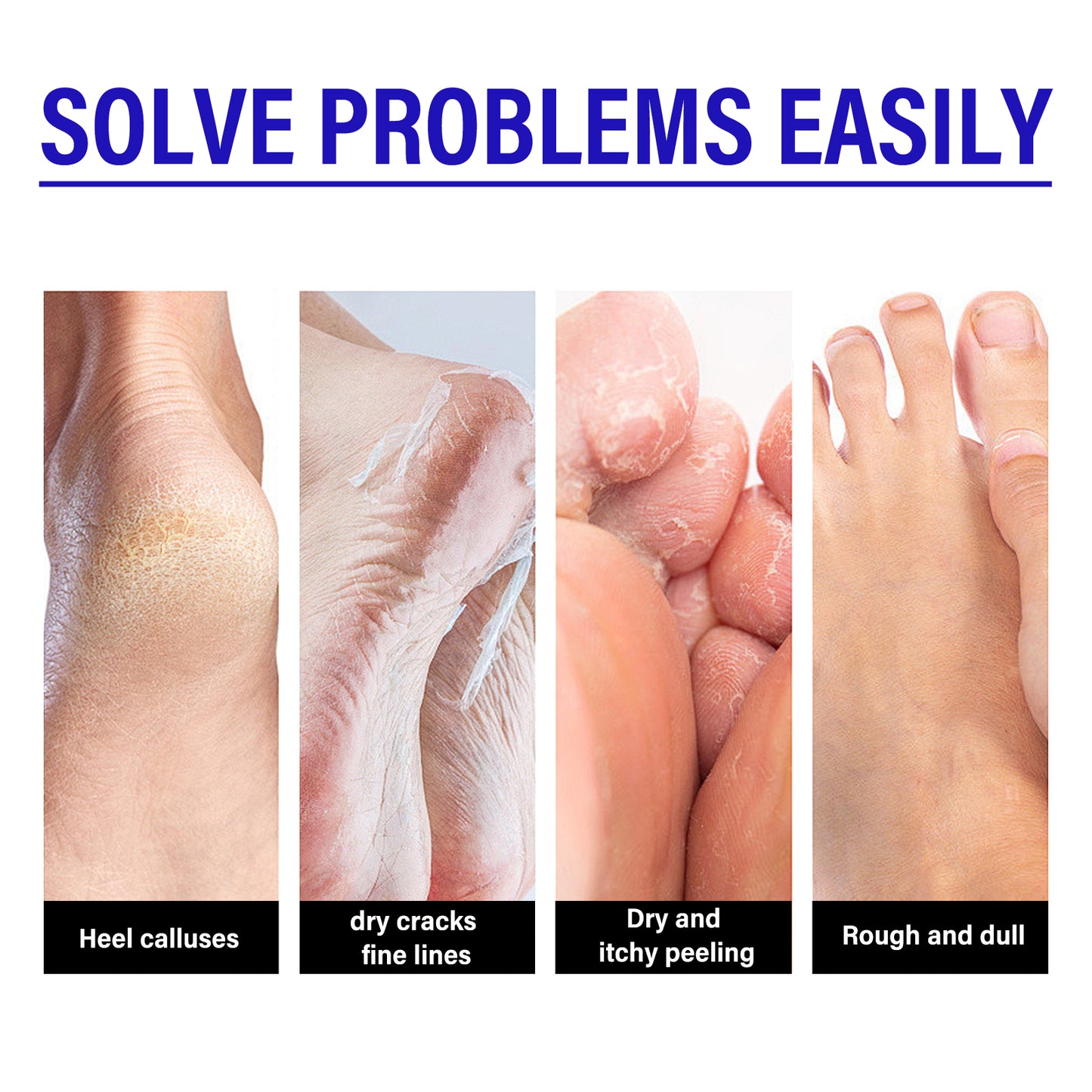 Heel Repair Cream Cleanses Dead Heel Calluses, Prevents Cracking And Peeling, And Moisturizes Foot Care Cream Health Eprolo https://www.cyberehub.com
