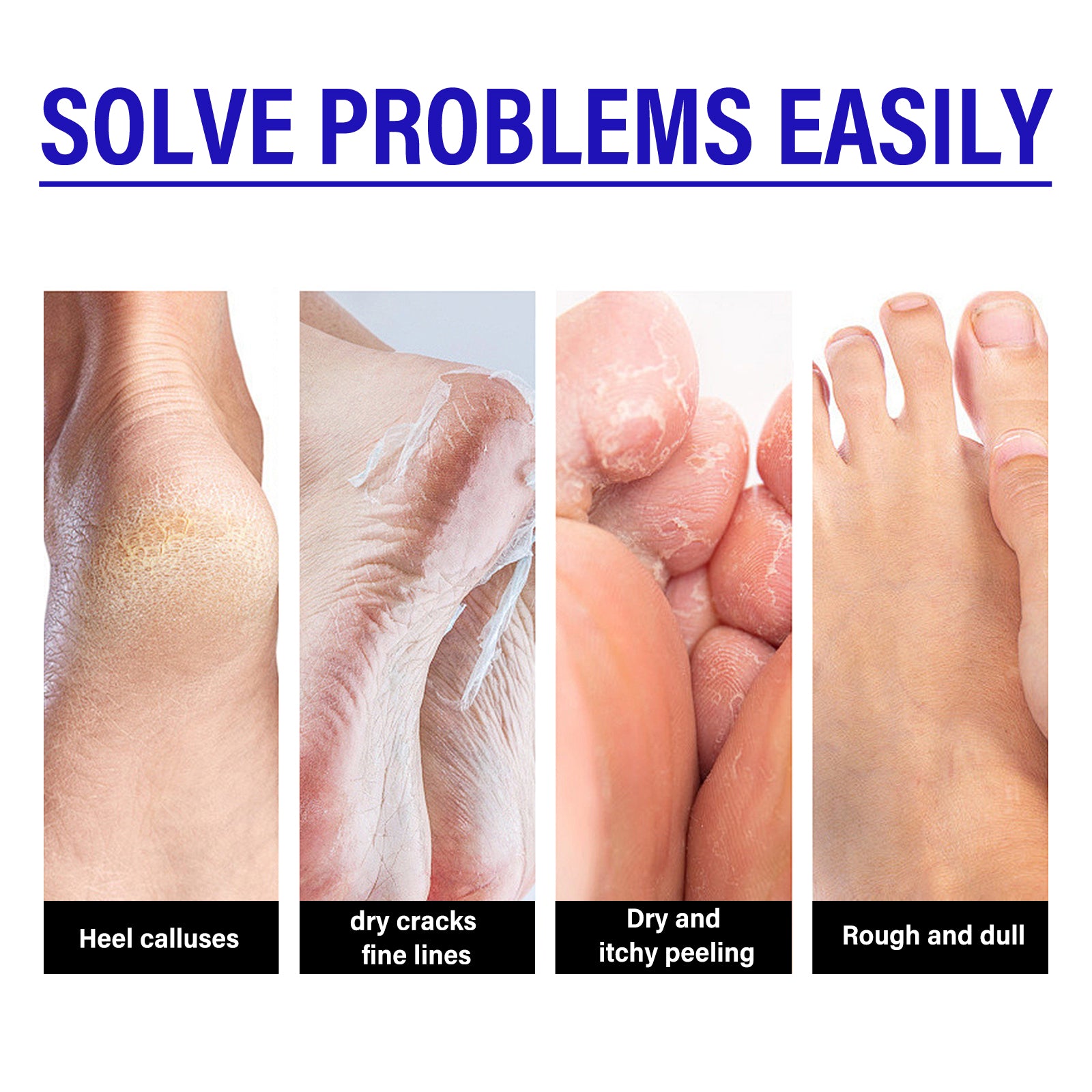Heel Repair Cream Cleanses Dead Heel Calluses, Prevents Cracking And Peeling, And Moisturizes Foot Care Cream Health Eprolo https://www.cyberehub.com