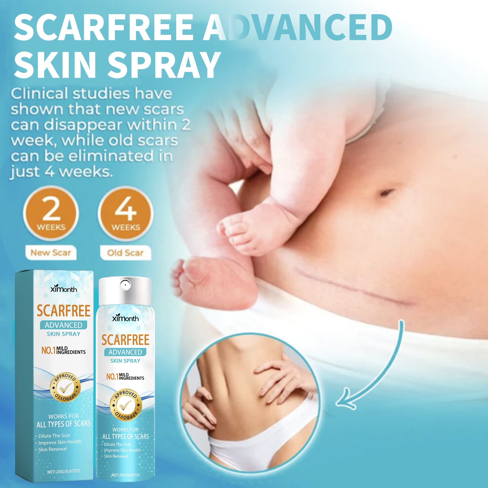 Scarfree Advanced Skin Spray, Body Skin Care Reduces Post-Natal Scars And Smooths Skin Health & Beauty Health Eprolo https://www.cyberehub.com
