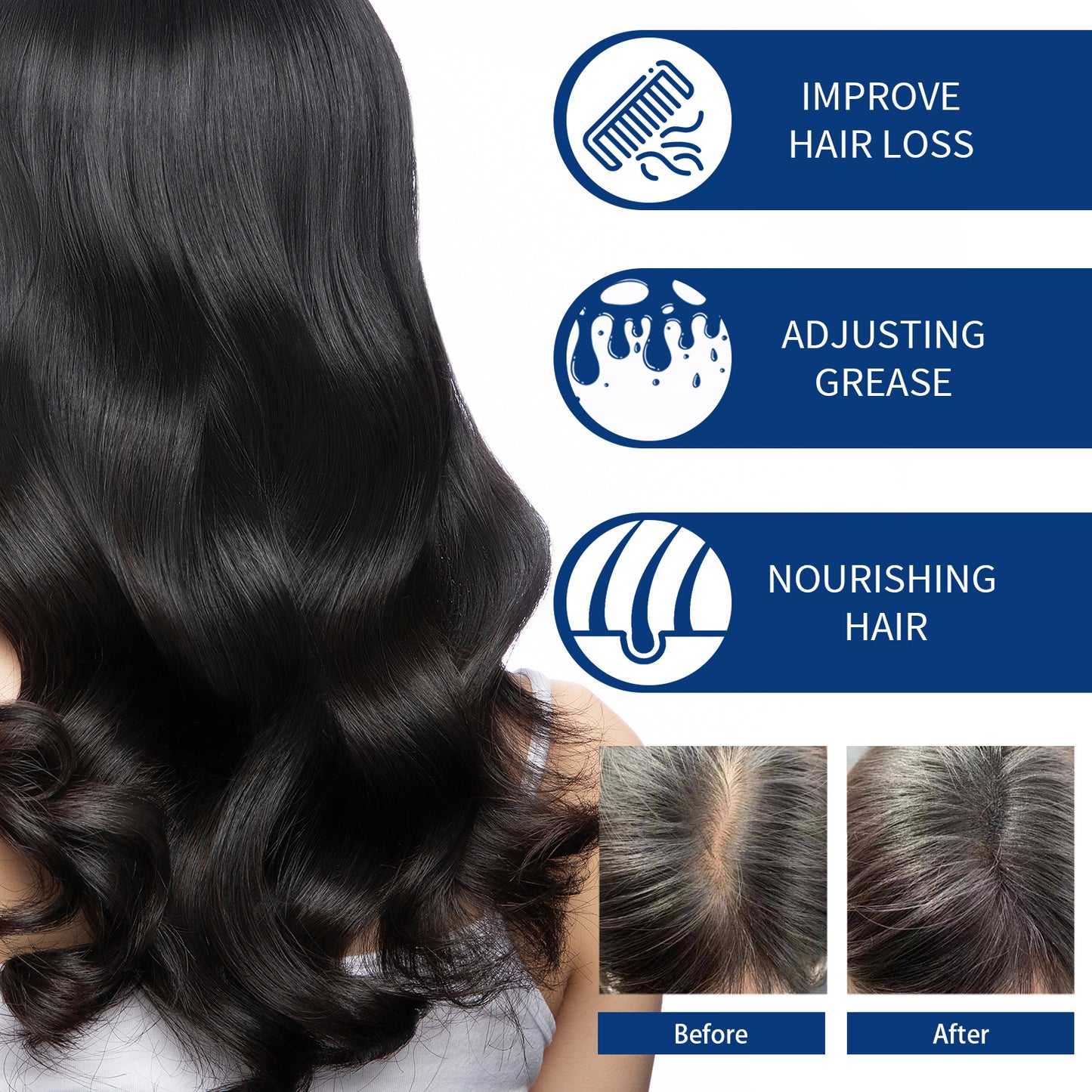 Hair Scrub Cleans Scalp Dandruff, Soothes Itchiness, Moisturizes Dense, Firming, And Prevents Hair Loss Health Eprolo https://www.cyberehub.com
