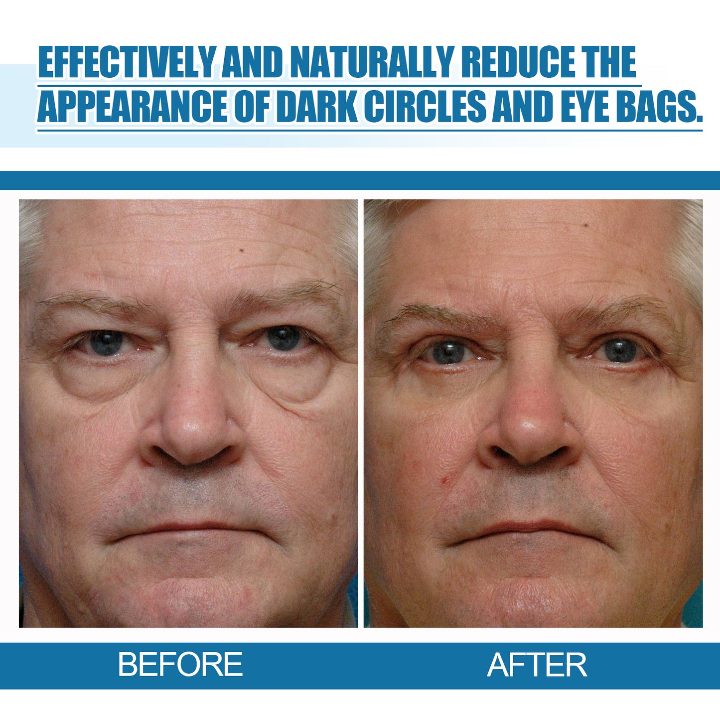Men's Eye Serum Reduces Fine Lines, Bags, Dark Circles, Moisturizes, Firming, Brightening And Anti-Aging Eye Area Health & Beauty Health Eprolo https://www.cyberehub.com