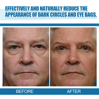 Men's Eye Serum Reduces Fine Lines, Bags, Dark Circles, Moisturizes, Firming, Brightening And Anti-Aging Eye Area Health & Beauty Health Eprolo https://www.cyberehub.com