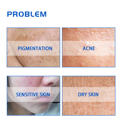 HOYGI Blueberry Facial Care Facial Skin Deep Cleansing Anti-Wrinkle Skin Care Essence Beauty Brightening Cream Health & Beauty Health Eprolo https://www.cyberehub.com