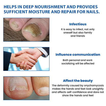 Nighttime Renewal Fungal Nail Patches, Repair And Thickening Gray Nail Insert Soft Nail Care Patch Health & Beauty Health Eprolo https://www.cyberehub.com