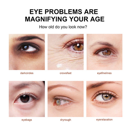 Snake Venom Eye Cream, Firming Eye Bags Hydrating And Reducing Fine Lines Eye Care Eye Cream Health Eprolo https://www.cyberehub.com