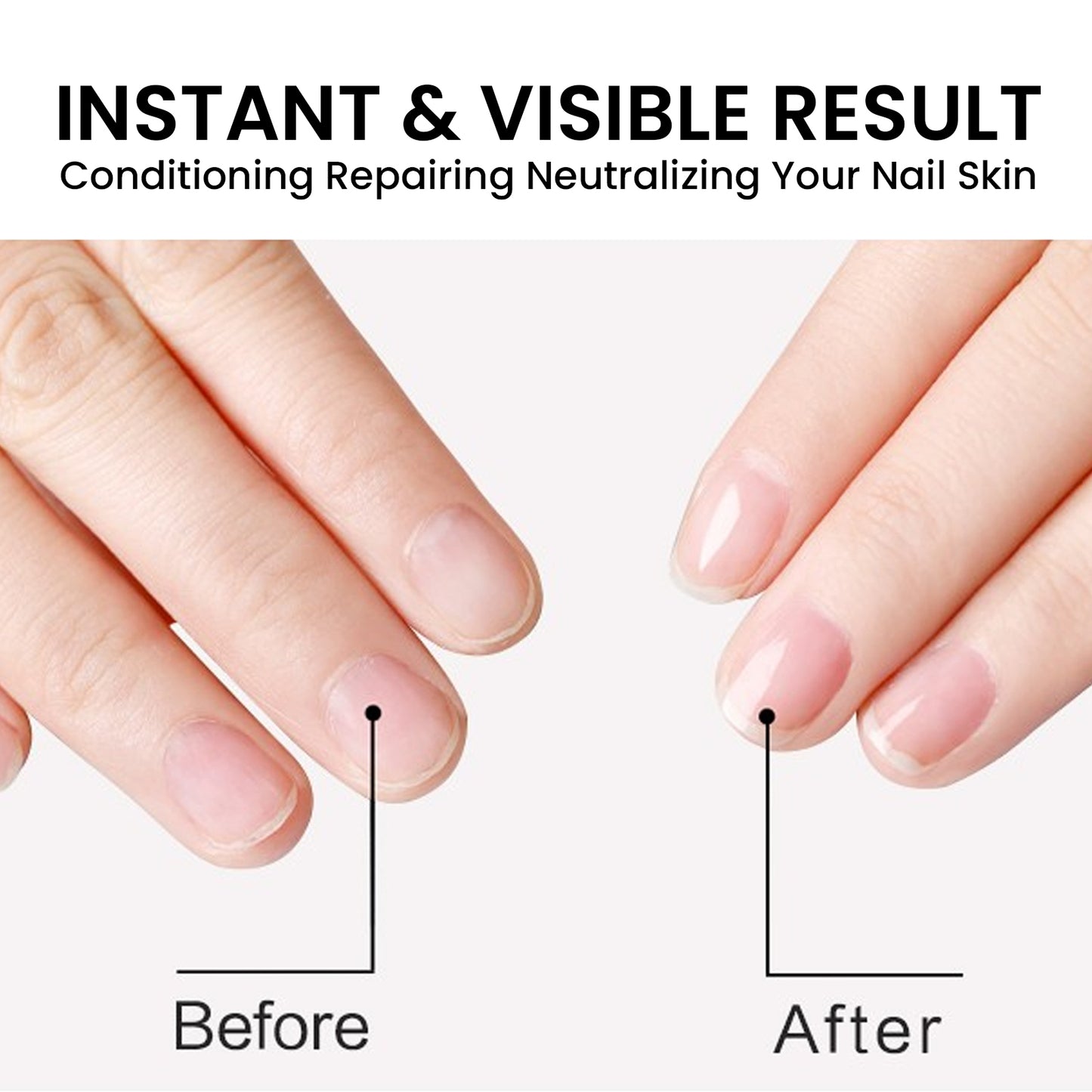 Nail Cuticle Oil, Repair Grey Nails Soft Nails Thickening Moisturizing And Brightening Nails Care Oil Health Eprolo https://www.cyberehub.com