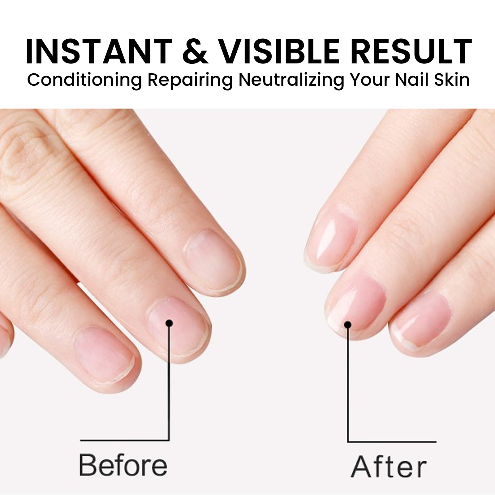 Nail Cuticle Oil, Repair Grey Nails Soft Nails Thickening Moisturizing And Brightening Nails Care Oil Health Eprolo https://www.cyberehub.com