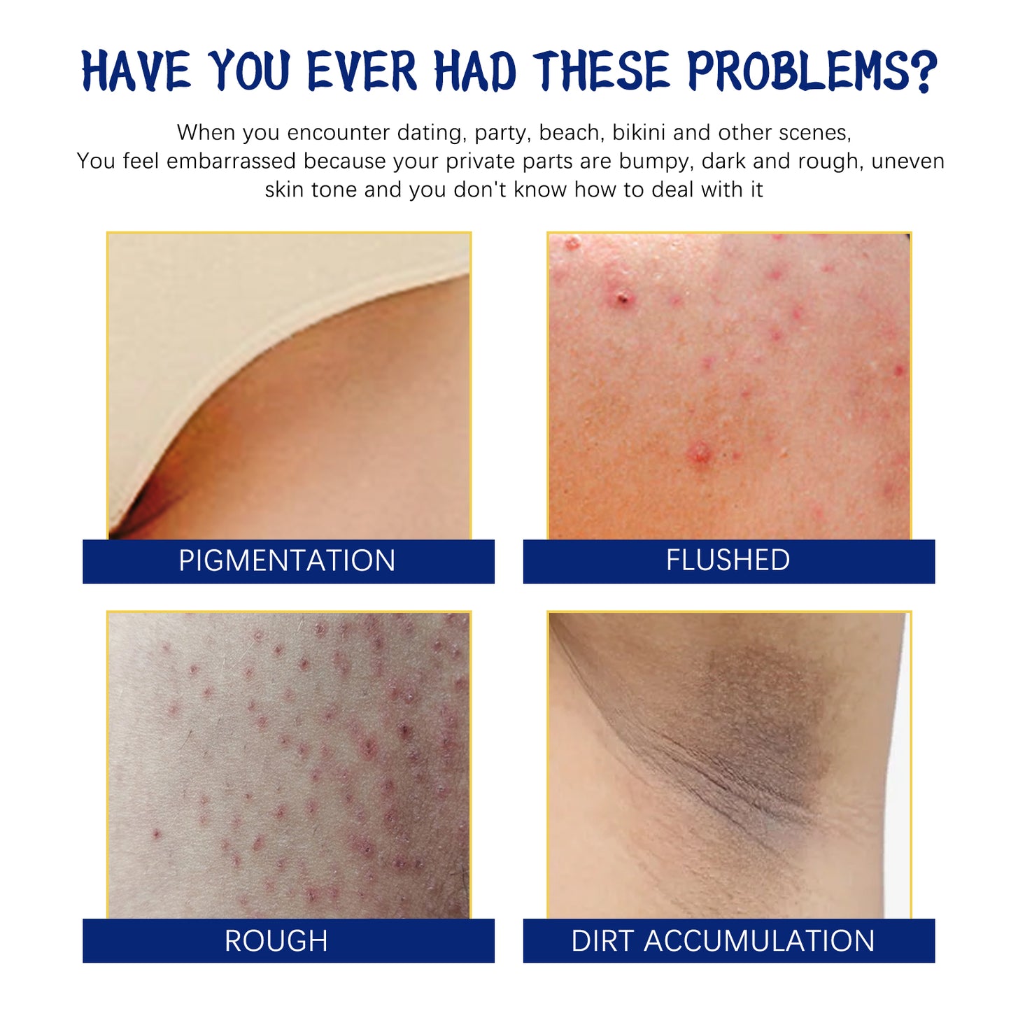Body Whitening Cream, Lightening Dull Skin Even Skin Tone Moisturizing Skin Beauty Cream Health Eprolo https://www.cyberehub.com