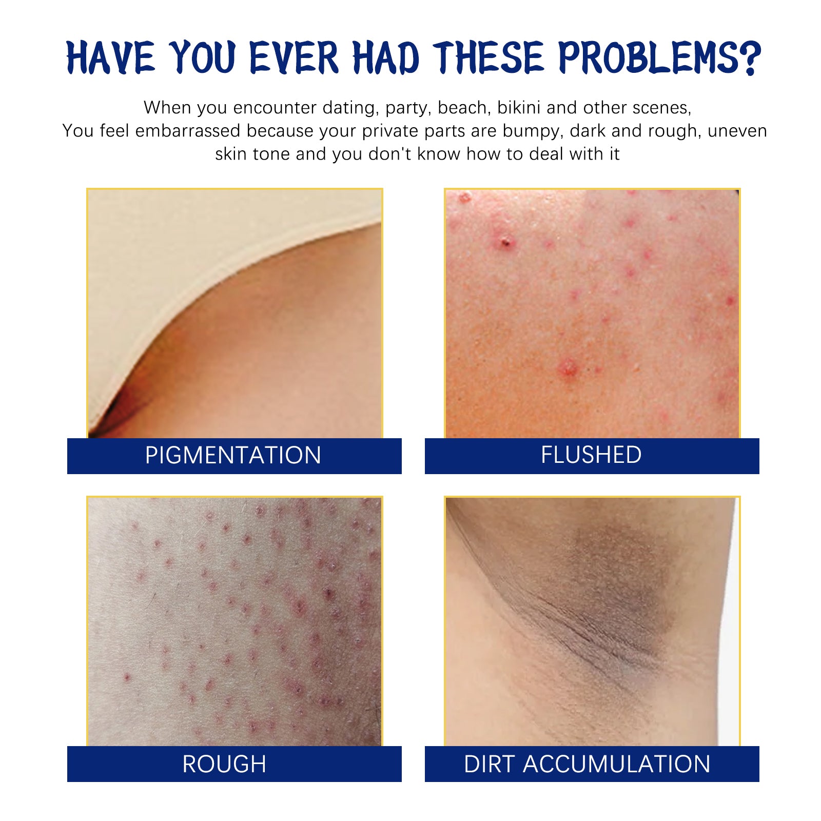 Body Whitening Cream, Lightening Dull Skin Even Skin Tone Moisturizing Skin Beauty Cream Health Eprolo https://www.cyberehub.com