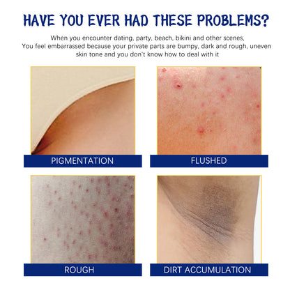Body Whitening Cream, Lightening Dull Skin Even Skin Tone Moisturizing Skin Beauty Cream Health Eprolo https://www.cyberehub.com